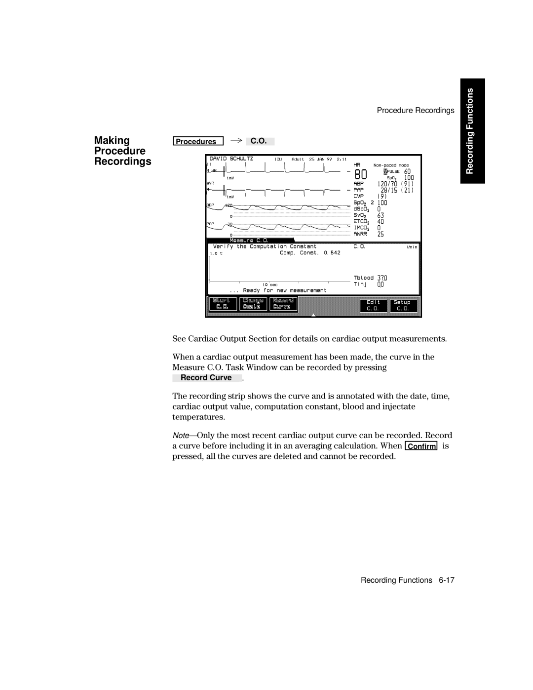 Philips V24CT, V26CT manual Making Procedure Recordings 