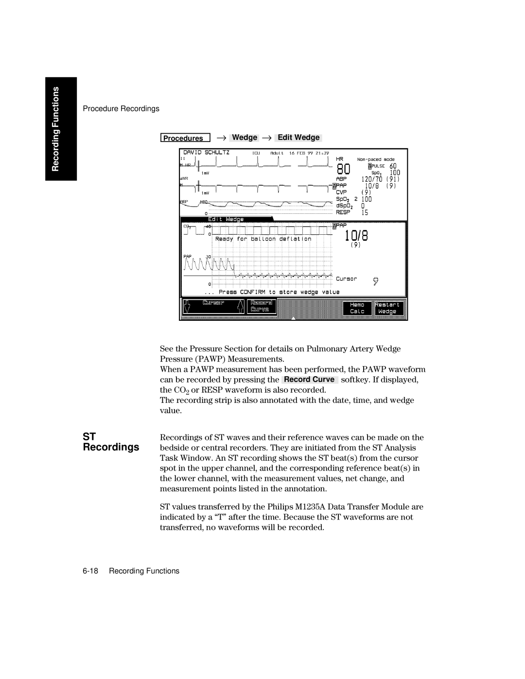 Philips V26CT, V24CT manual ST Recordings 