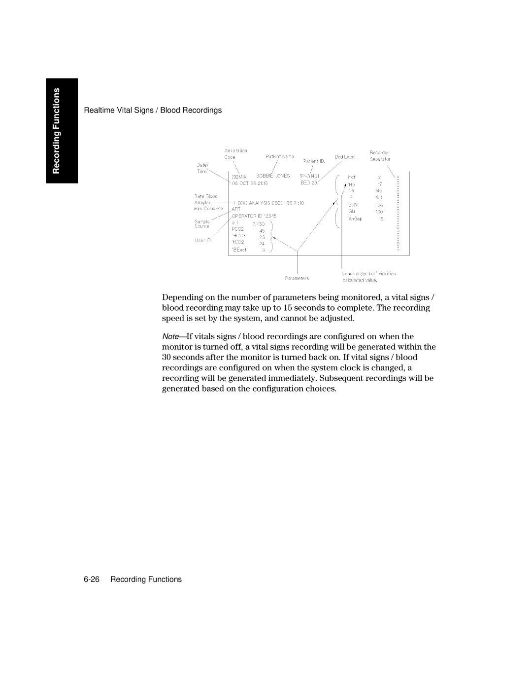 Philips V26CT, V24CT manual Recording Functions 