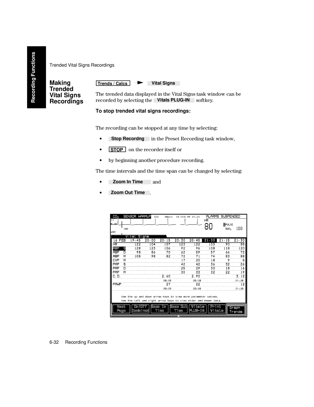 Philips V26CT, V24CT manual Making Trended Vital Signs Recordings, To stop trended vital signs recordings 