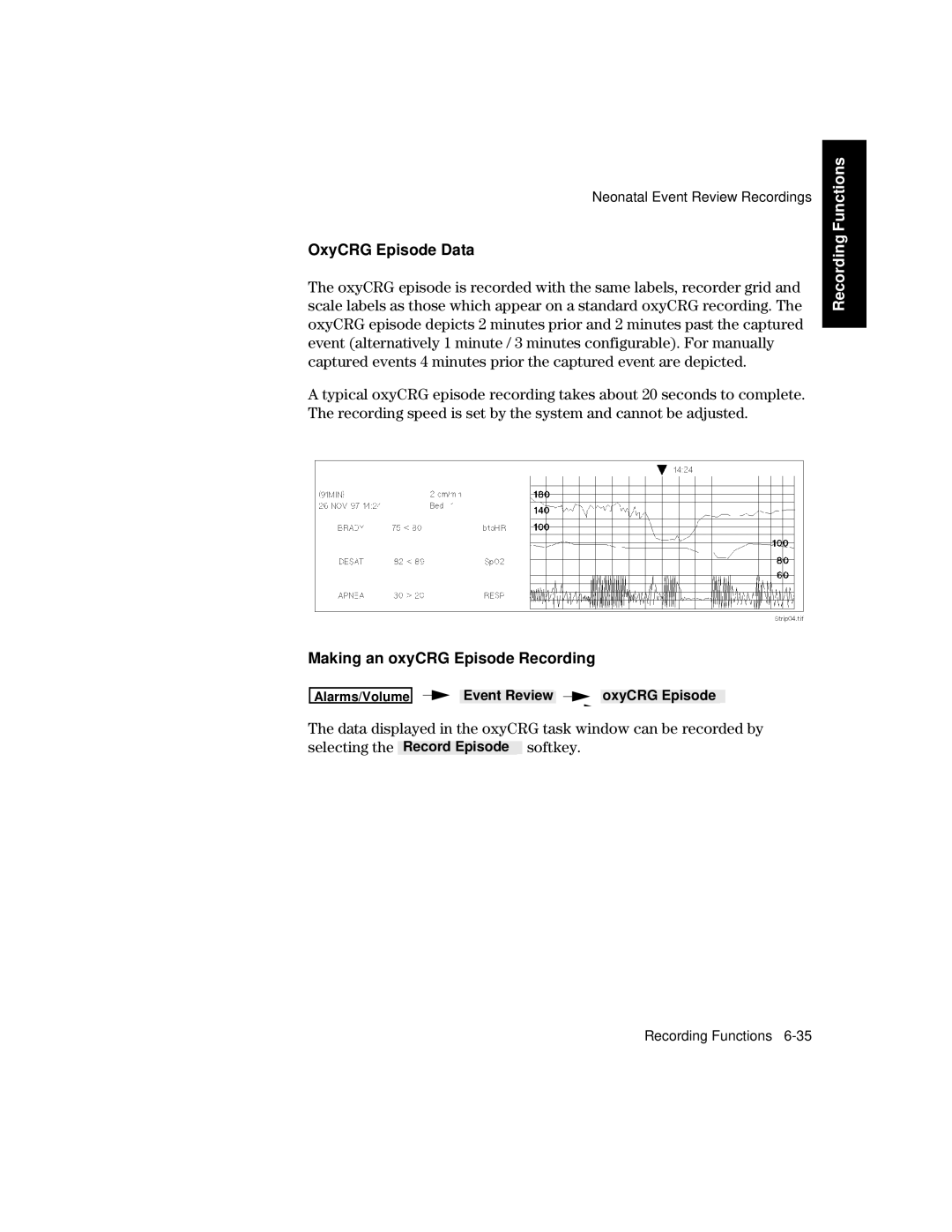 Philips V24CT, V26CT manual OxyCRG Episode Data, Making an oxyCRG Episode Recording 