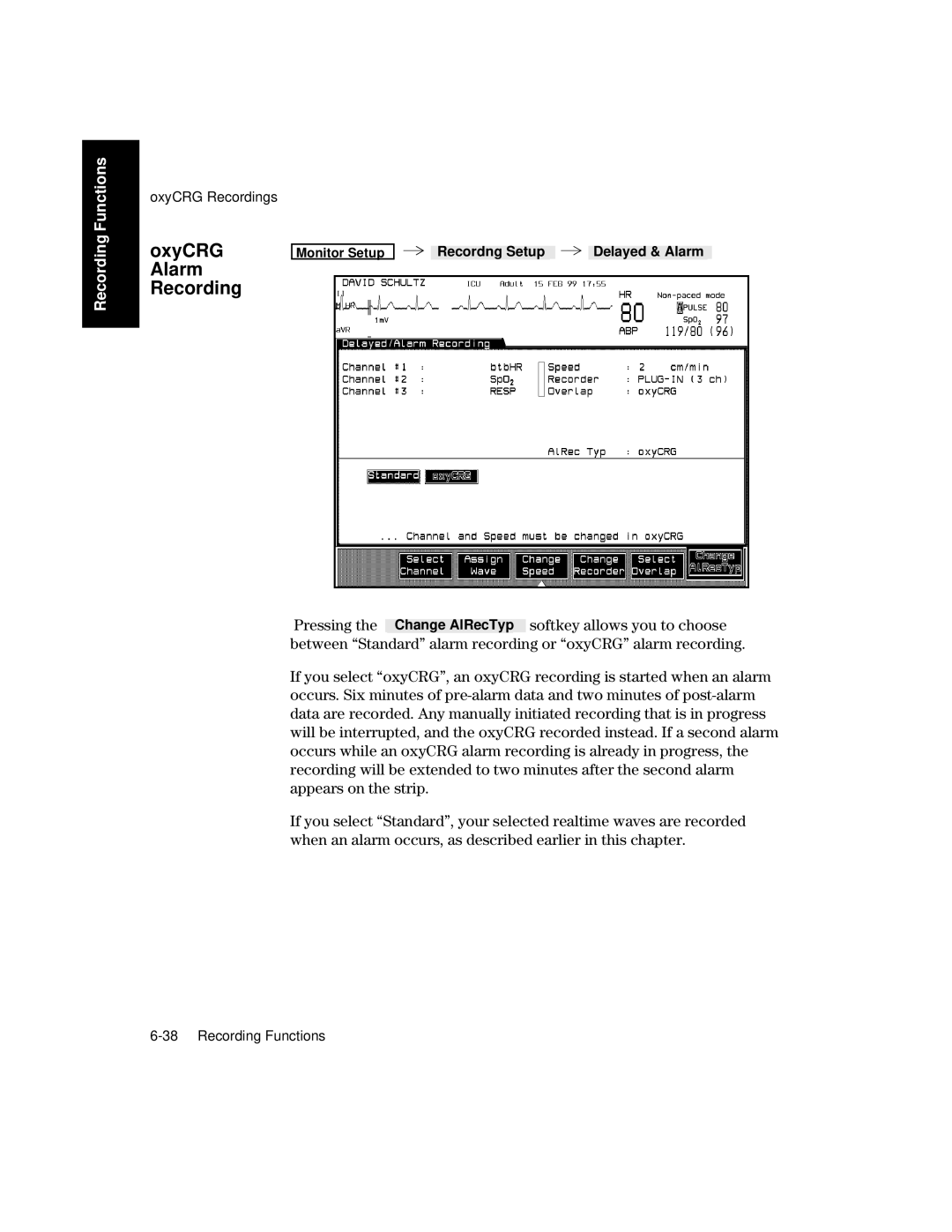 Philips V26CT, V24CT manual OxyCRG, Alarm Recording 