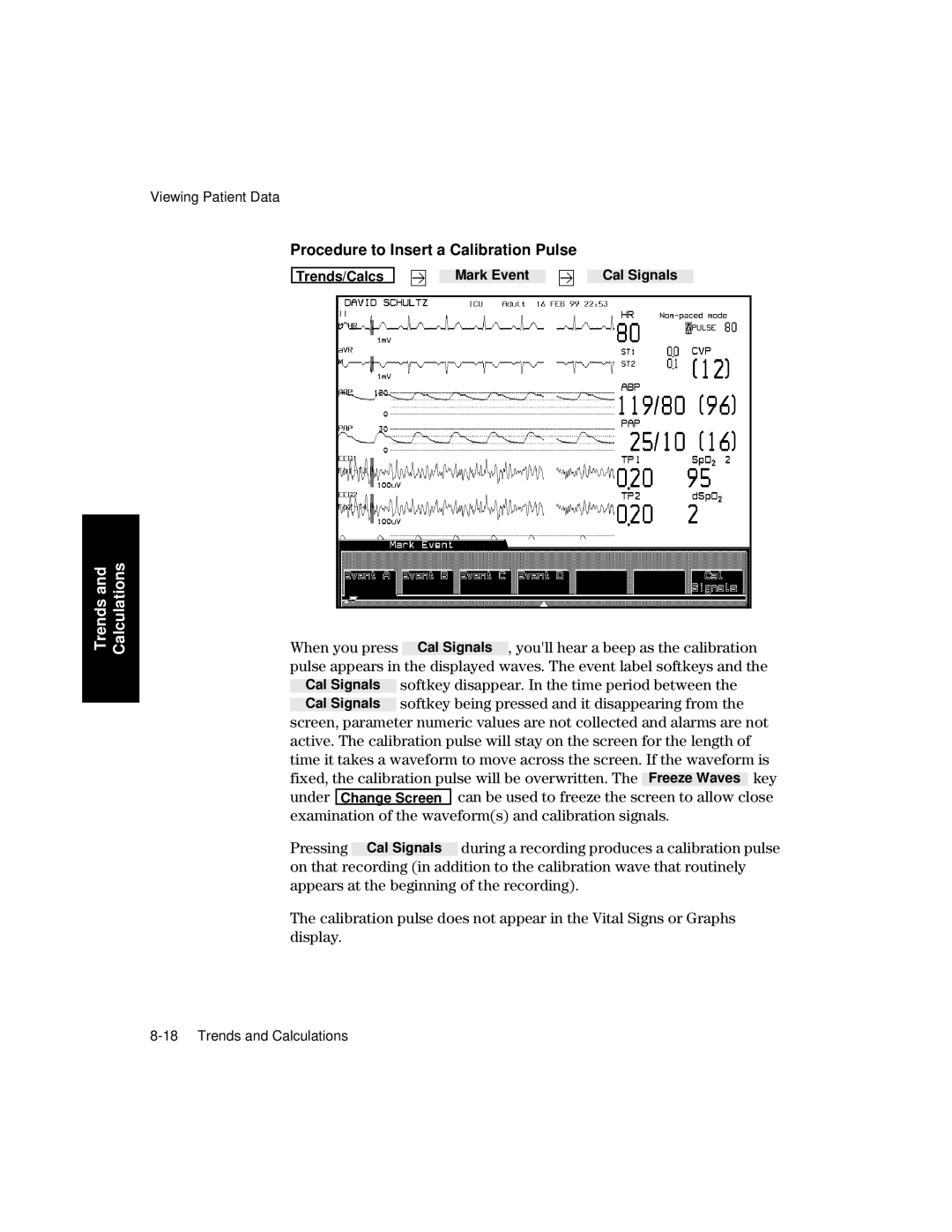 Philips V26CT, V24CT manual Procedure to Insert a Calibration Pulse, Examination of the waveforms and calibration signals 