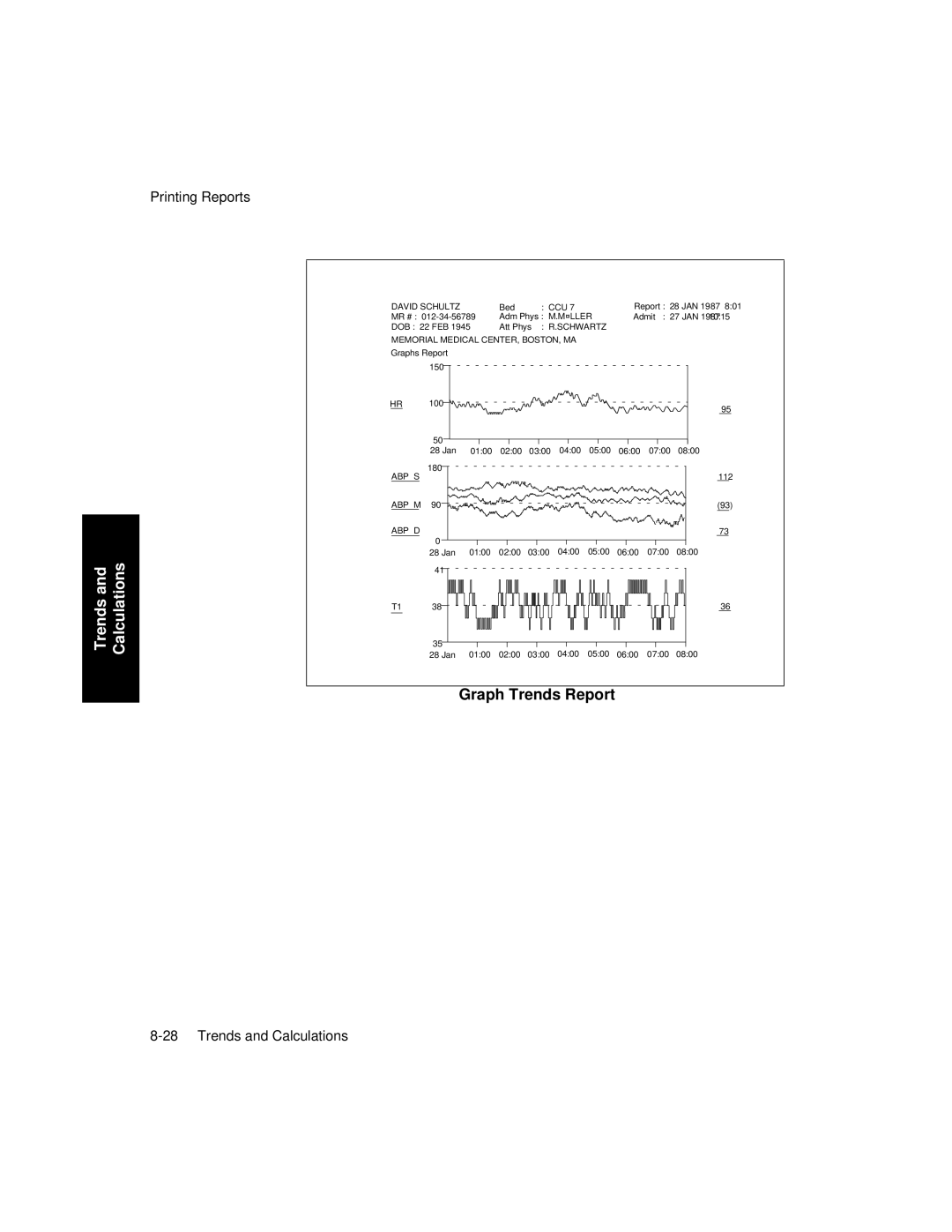 Philips V26CT, V24CT manual Graph Trends Report 