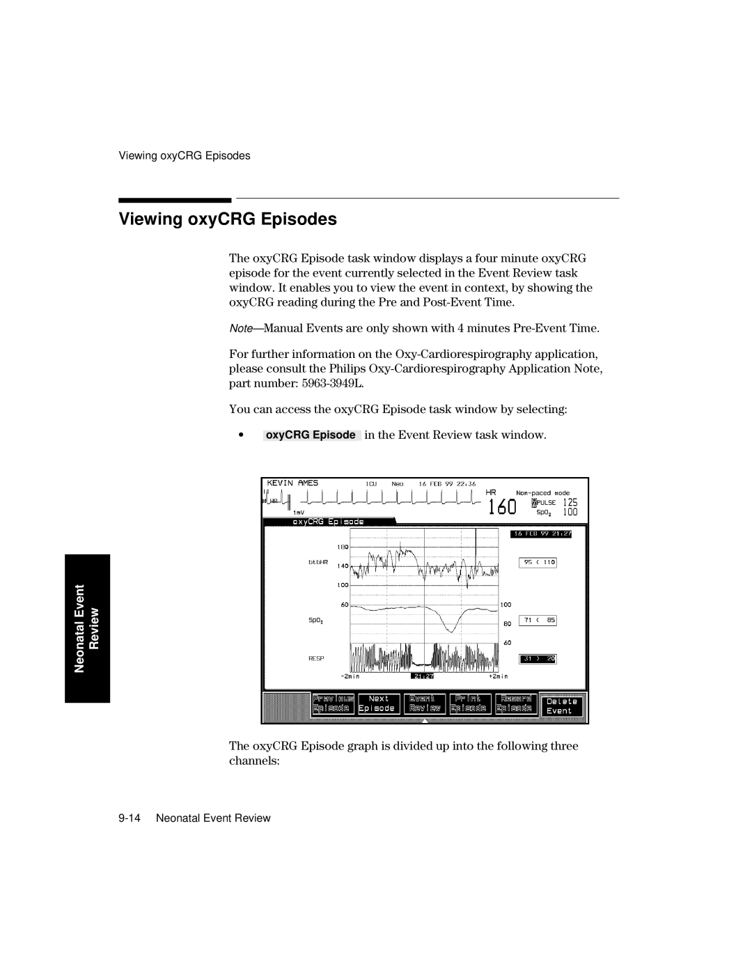 Philips V26CT, V24CT manual Viewing oxyCRG Episodes 