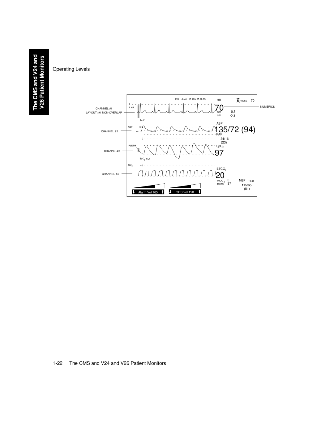 Philips V26CT, V24CT manual 135/72 