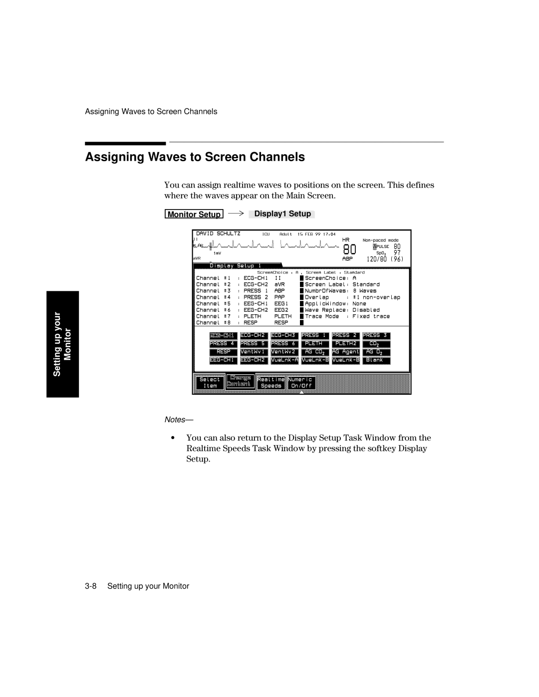 Philips V26CT, V24CT manual Assigning Waves to Screen Channels 