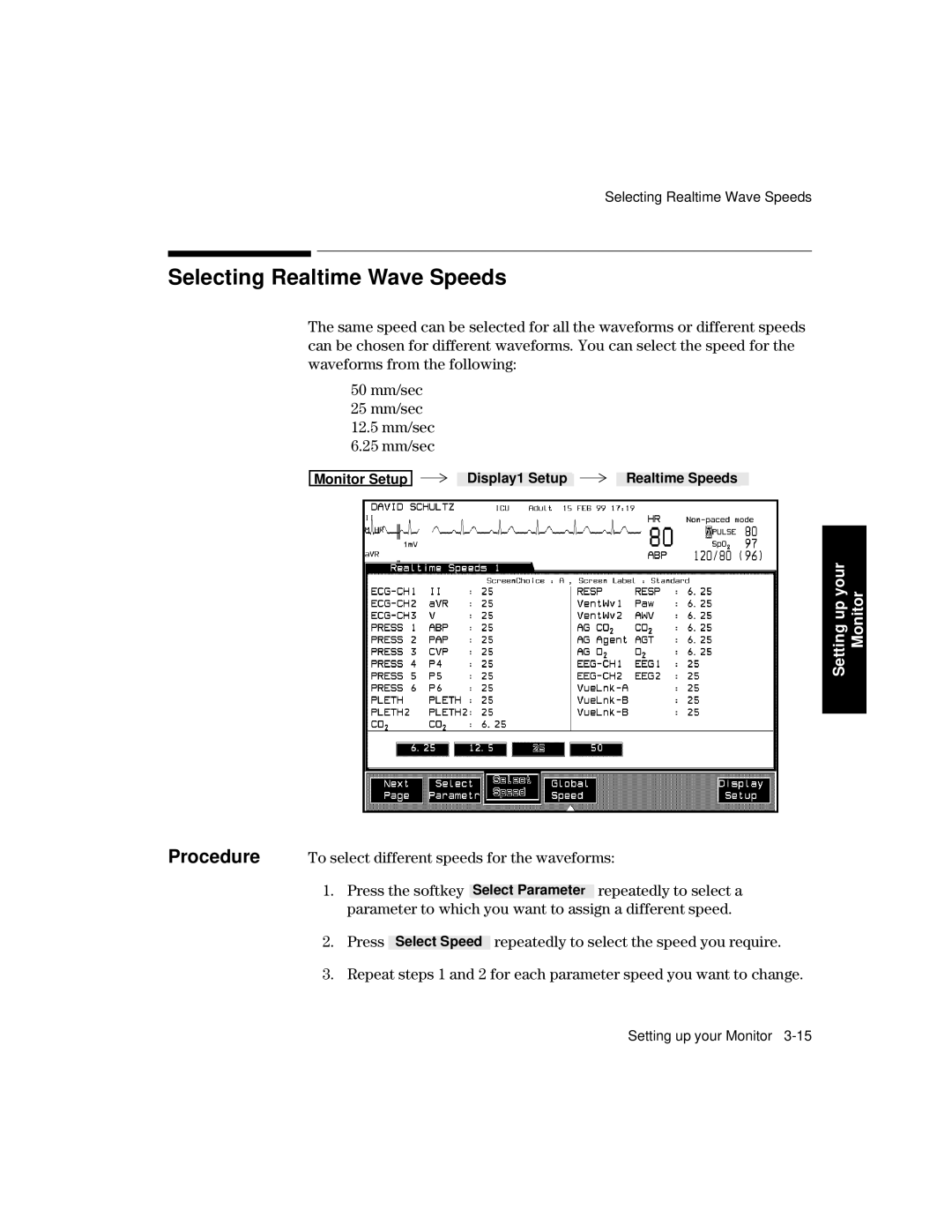 Philips V24CT, V26CT manual Selecting Realtime Wave Speeds 