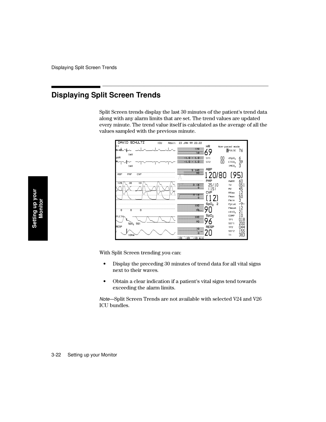 Philips V26CT, V24CT manual Displaying Split Screen Trends 