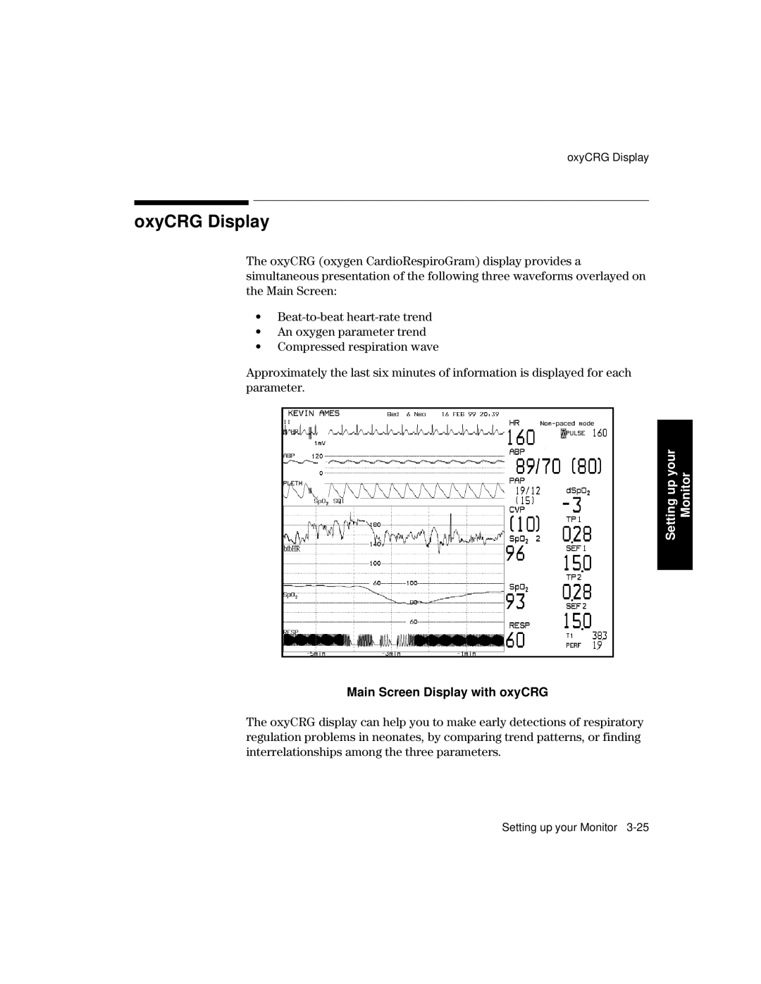 Philips V24CT, V26CT manual OxyCRG Display, Main Screen Display with oxyCRG 