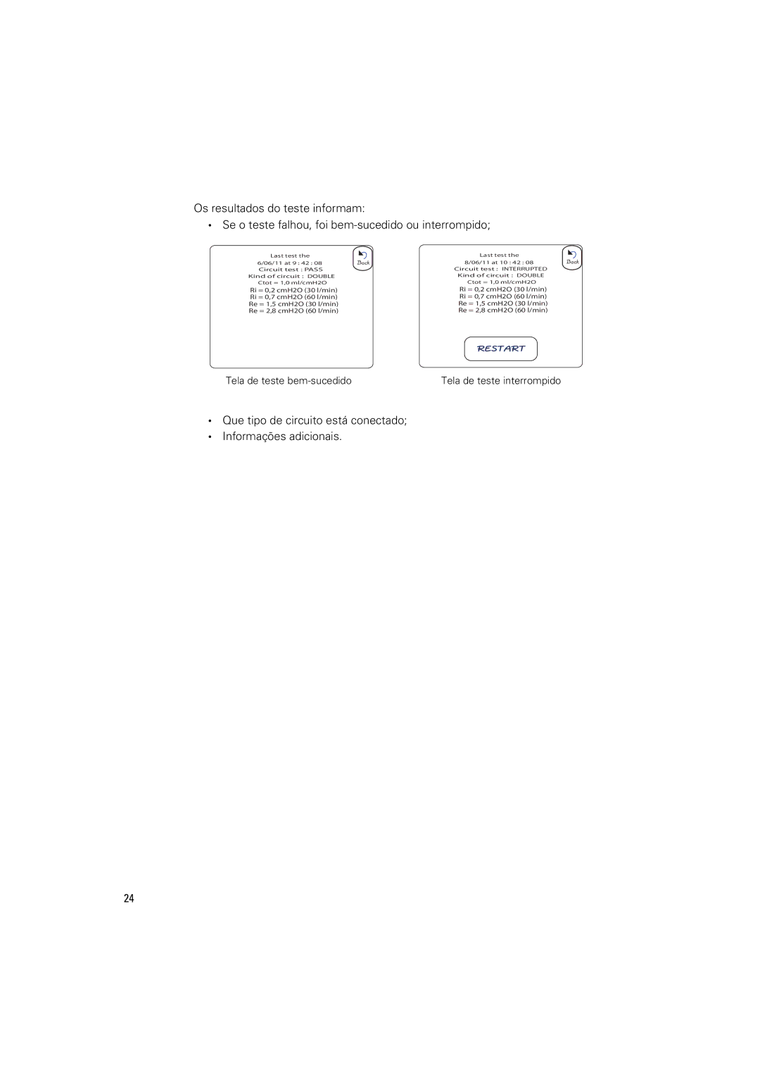 ResMed Elisee 150 manual Que tipo de circuito está conectado Informações adicionais 