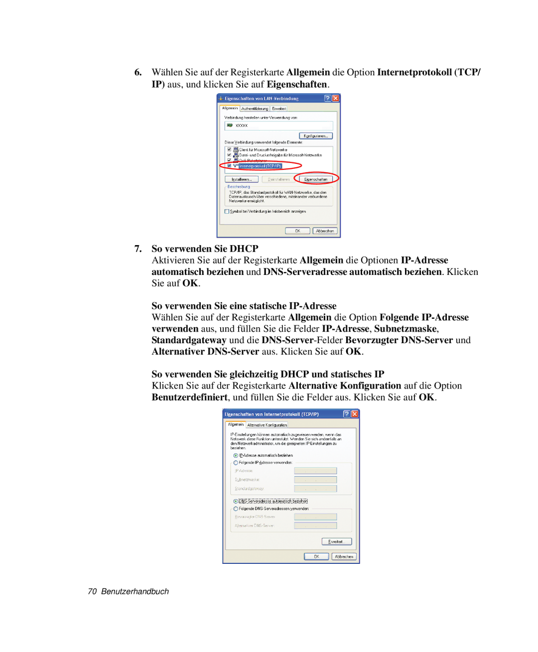 Samsung NP-X20CV08/SEG, NP-X20T002/SEG, NP-X20C00B/SEG So verwenden Sie Dhcp, So verwenden Sie eine statische IP-Adresse 