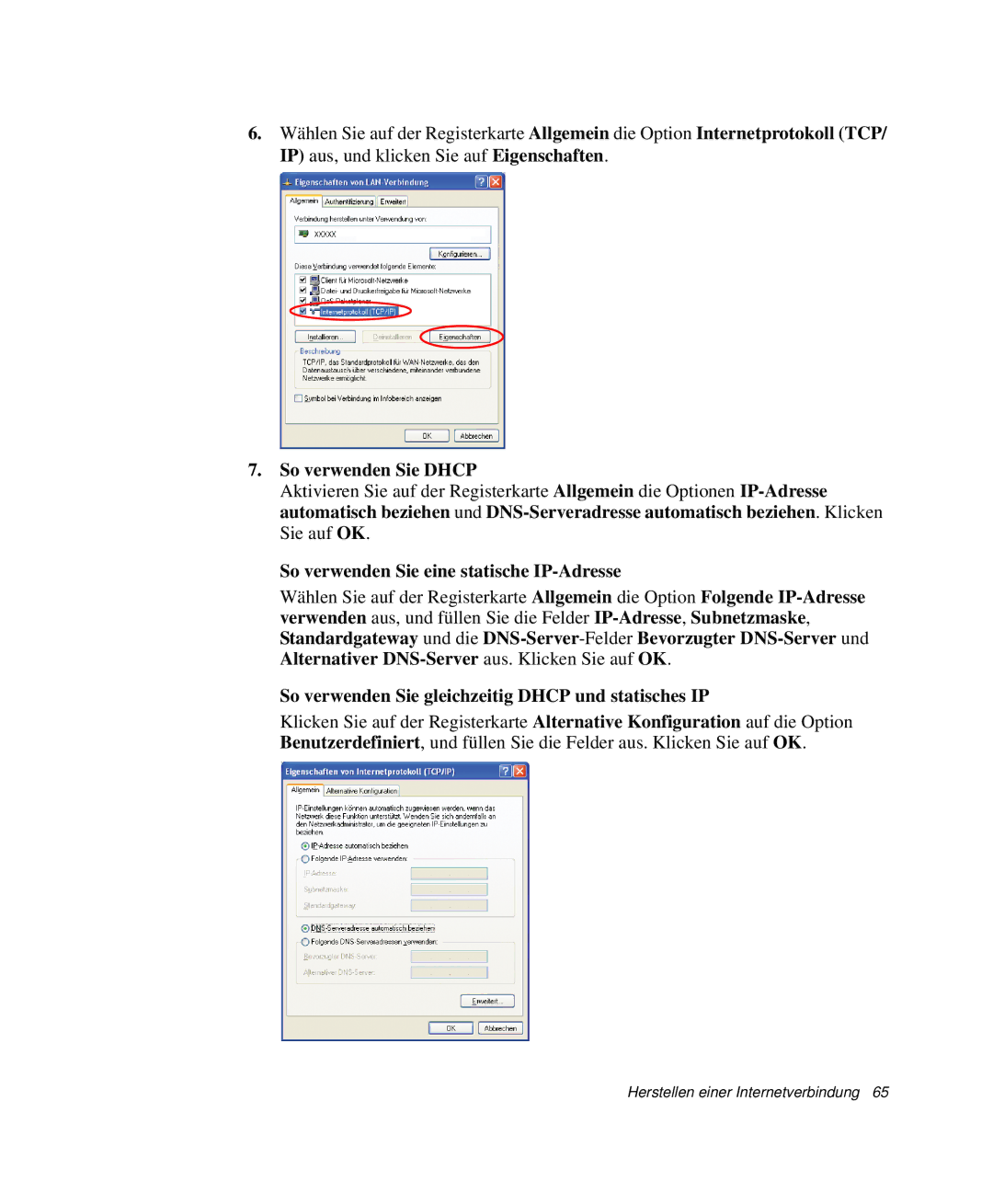 Samsung NP-X60TZ02/SEG, NP-X60TZ01/SEG, NP-X60TZ03/SEG So verwenden Sie Dhcp, So verwenden Sie eine statische IP-Adresse 