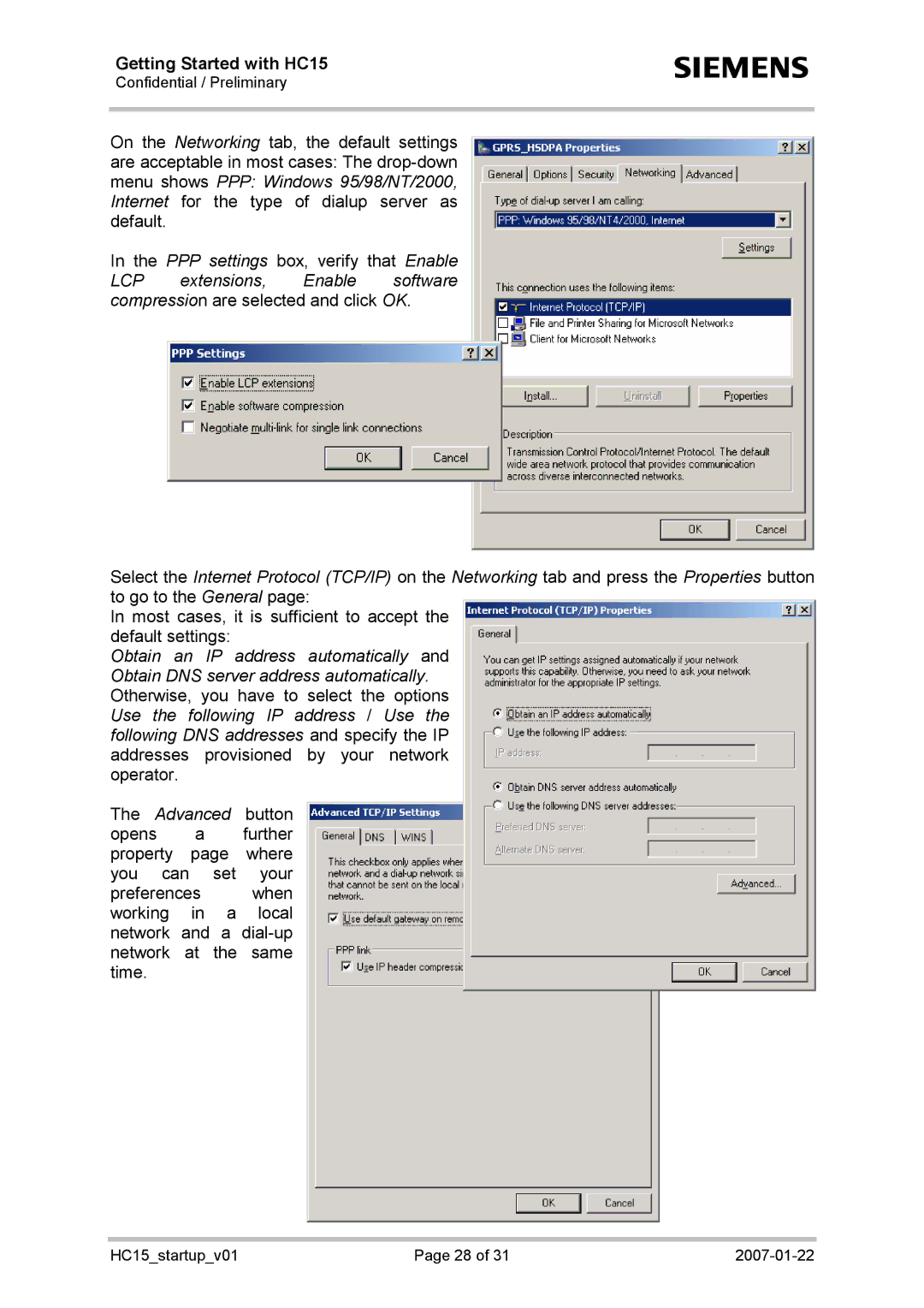 Siemens HC15 manual Most cases, it is sufficient to accept the default settings 