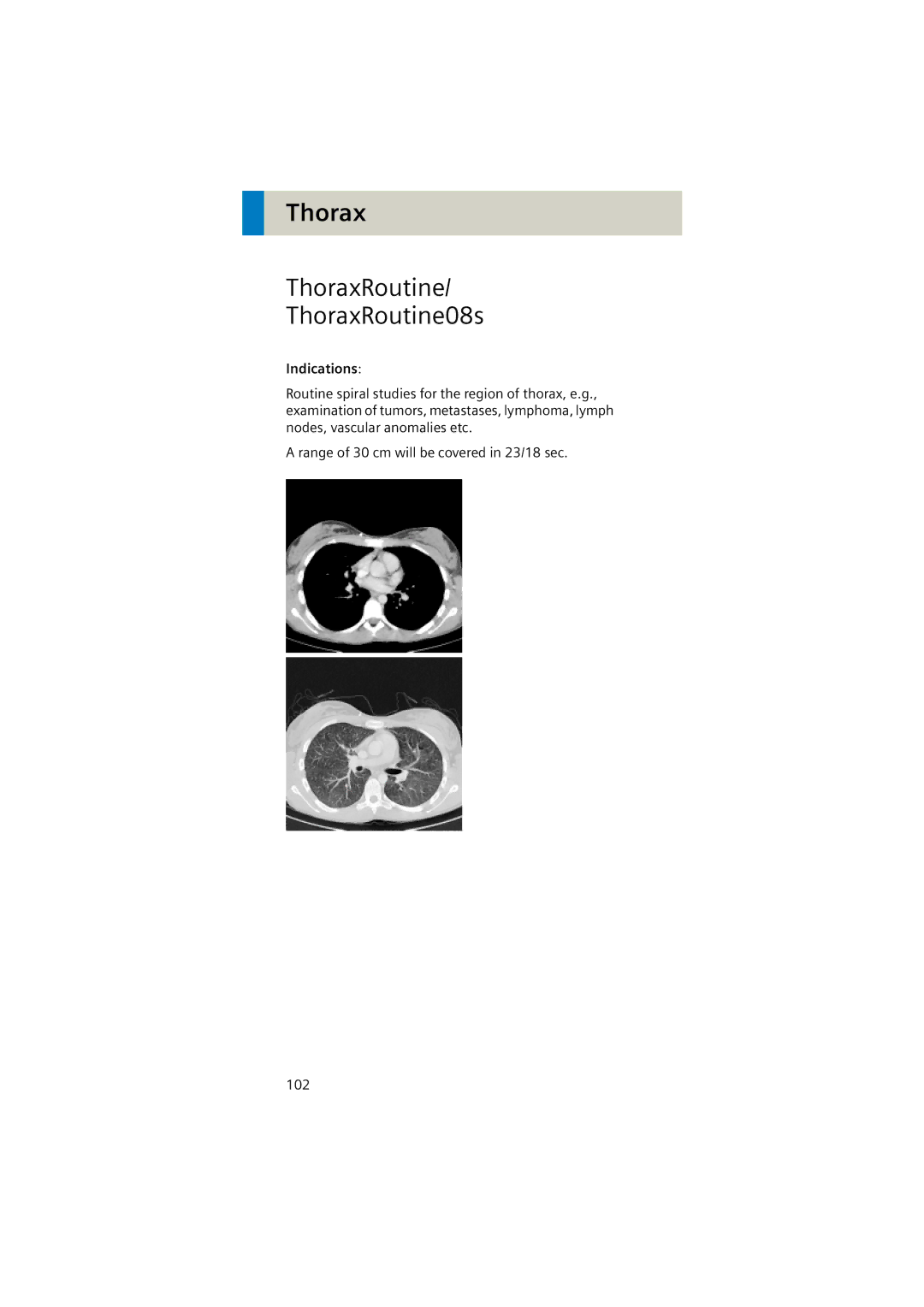 Siemens Software version syngo CT 2005C manual ThoraxRoutine ThoraxRoutine08s, Indications 