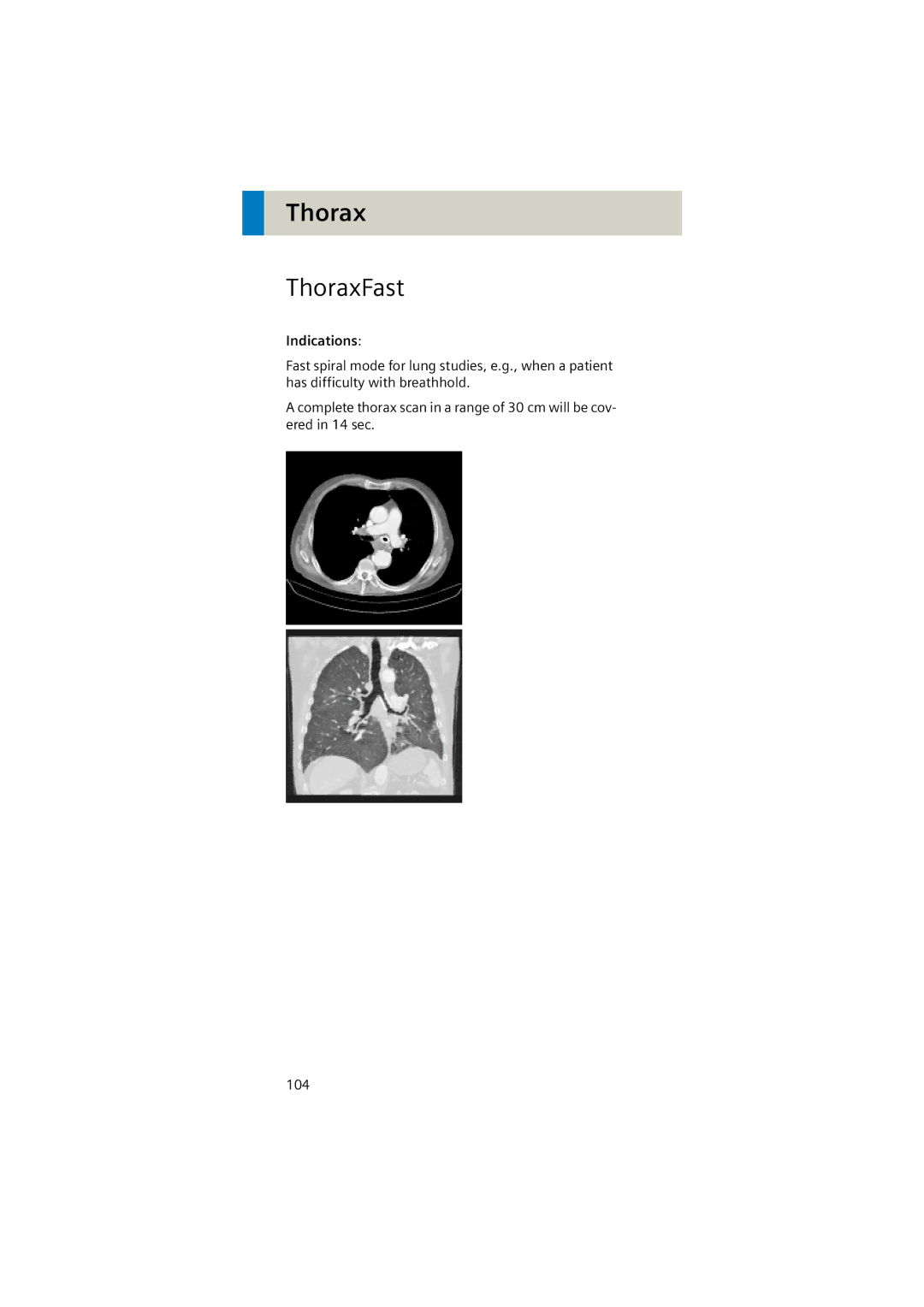 Siemens Software version syngo CT 2005C manual ThoraxFast 