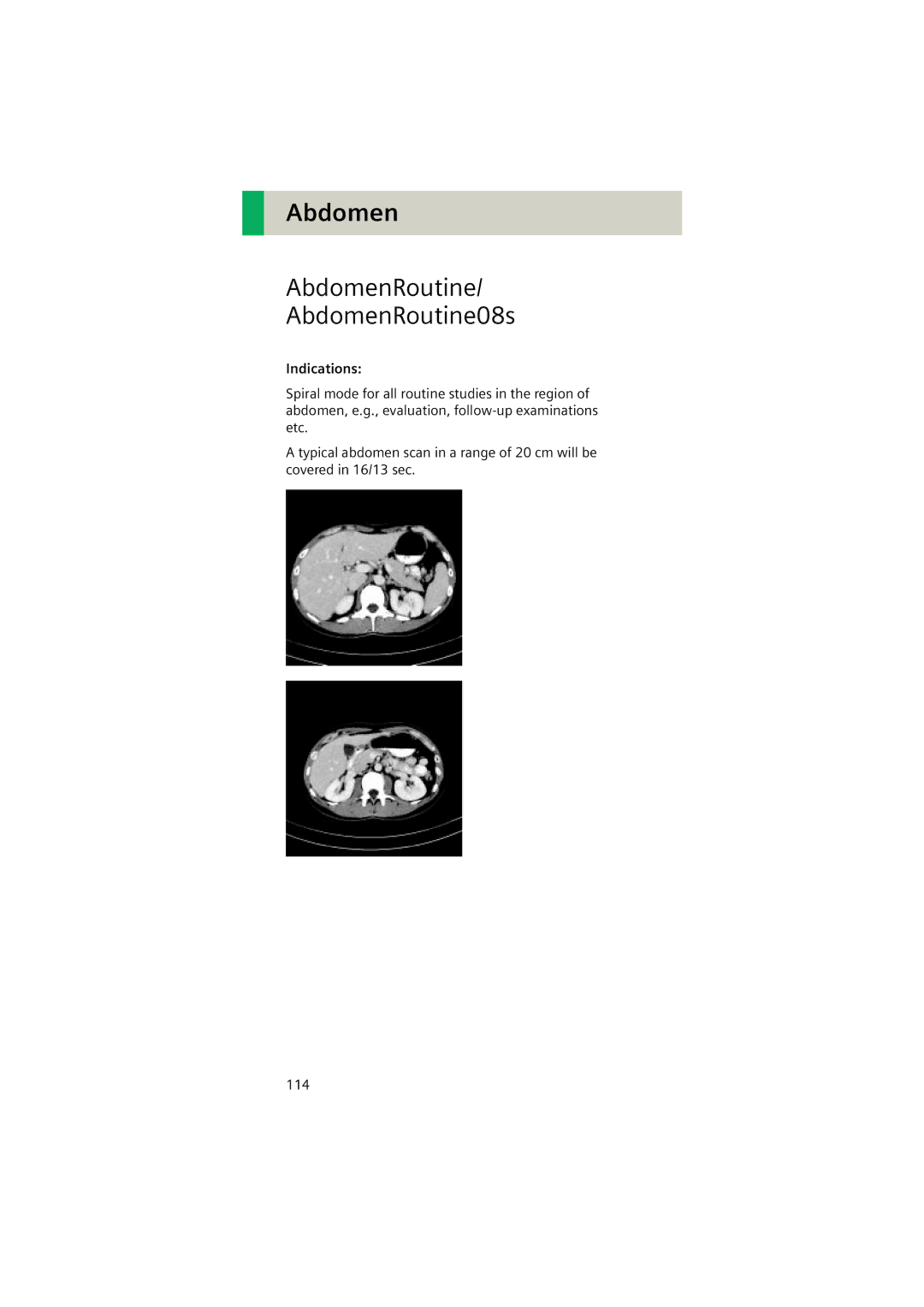 Siemens Software version syngo CT 2005C manual AbdomenRoutine AbdomenRoutine08s, Indications 