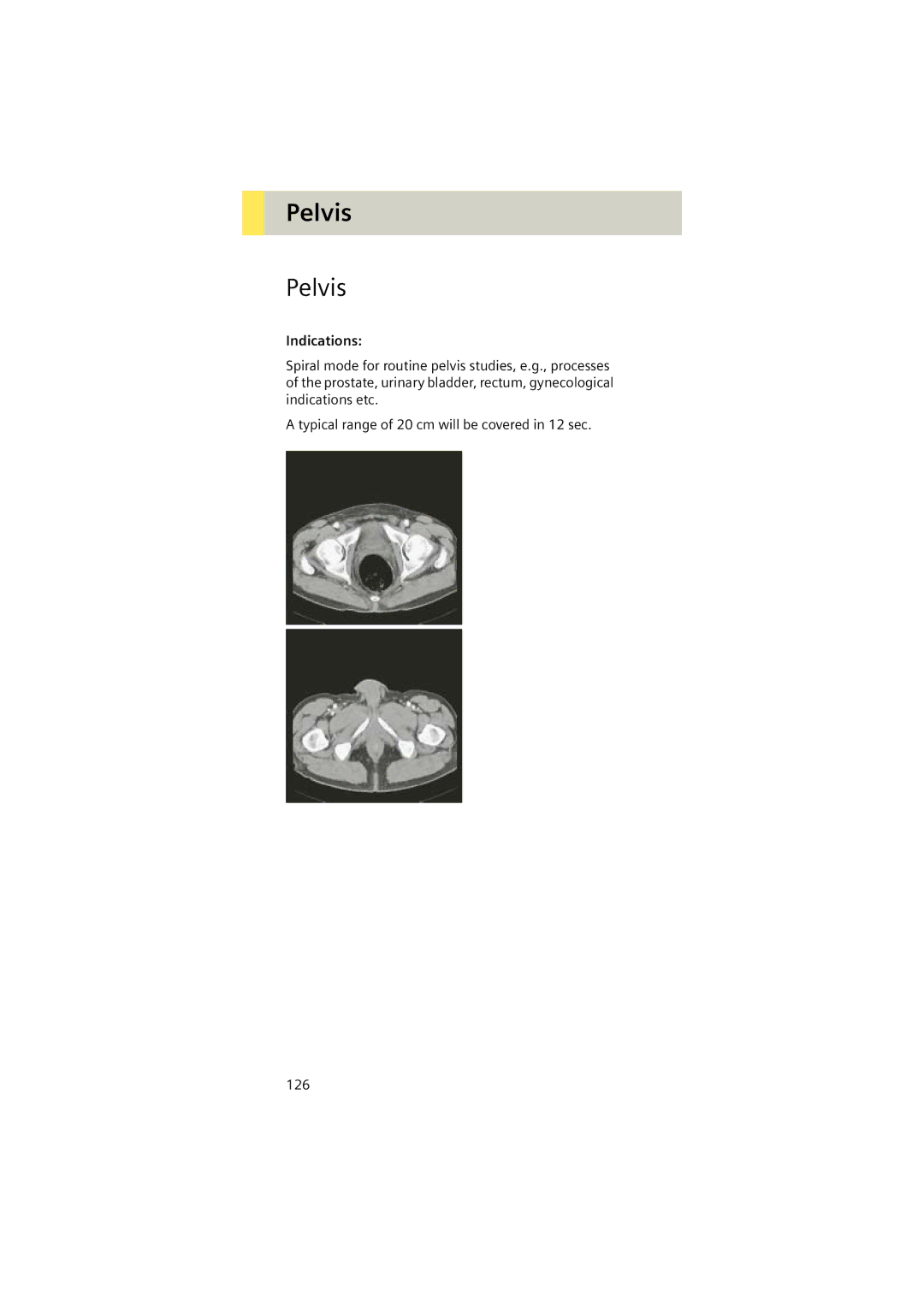 Siemens Software version syngo CT 2005C manual Pelvis, Indications 