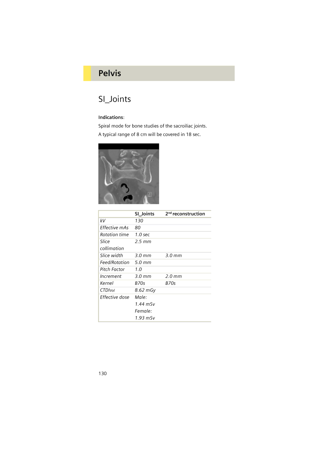 Siemens Software version syngo CT 2005C manual SIJoints 2nd reconstruction 