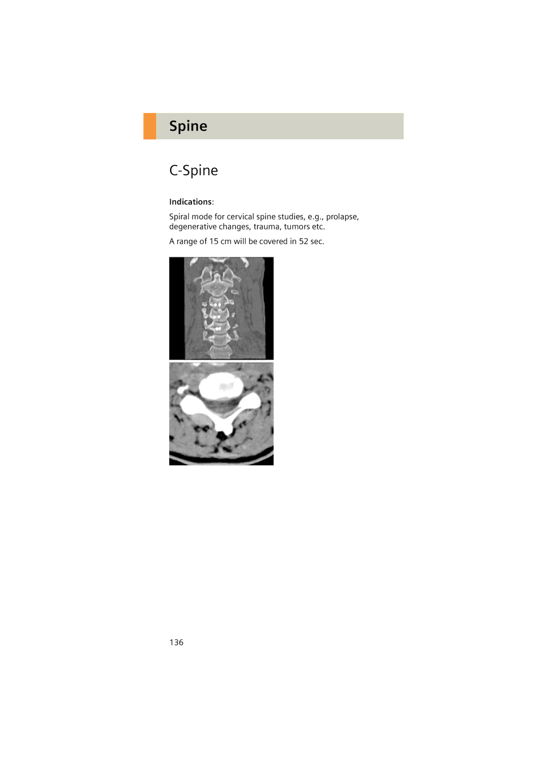 Siemens Software version syngo CT 2005C manual Spine, Indications 