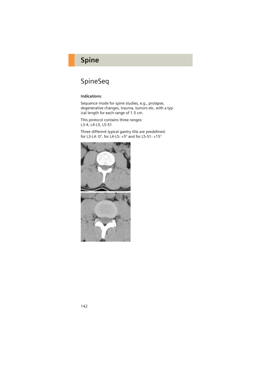 Siemens Software version syngo CT 2005C manual SpineSeq 