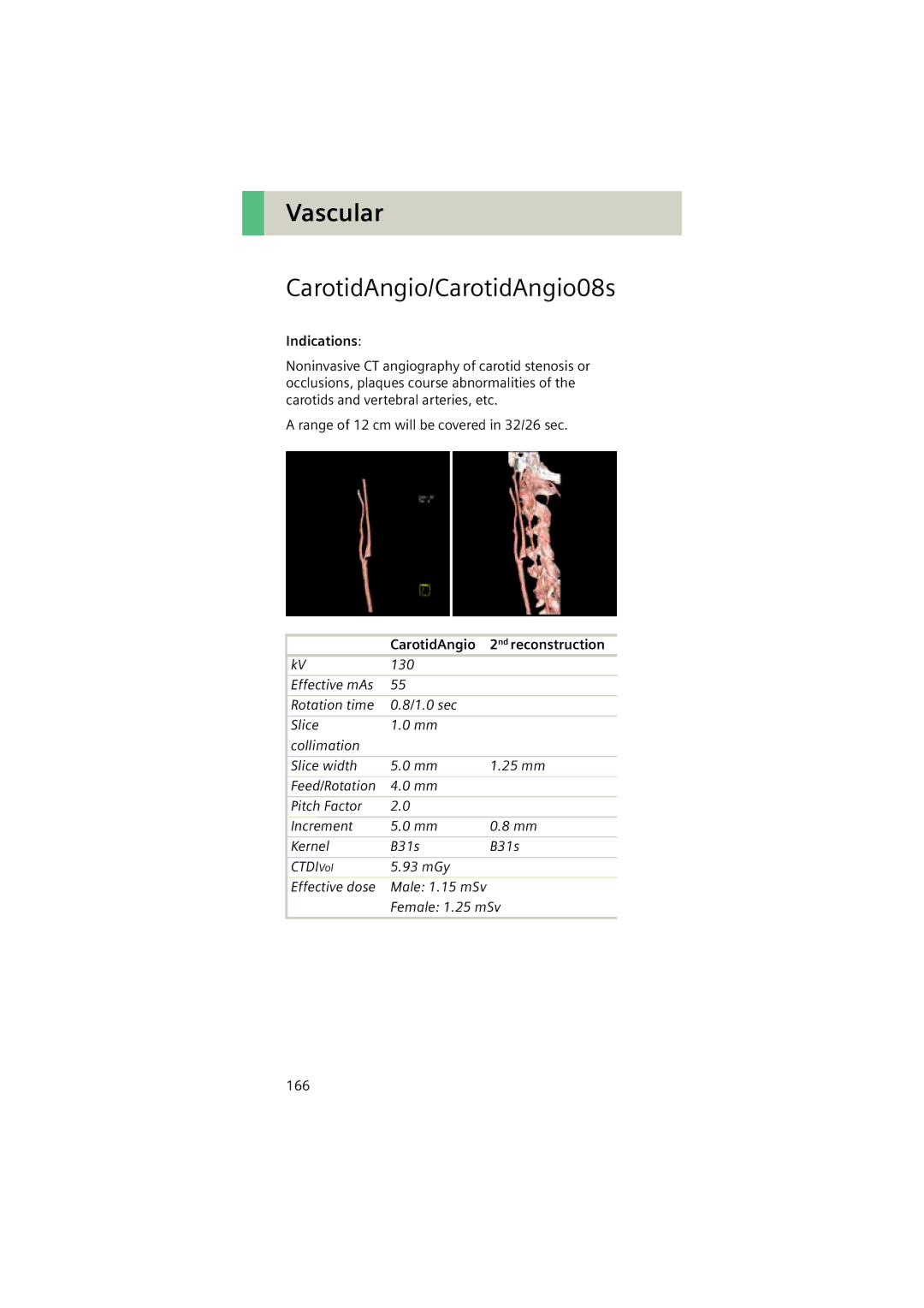 Siemens Software version syngo CT 2005C manual CarotidAngio/CarotidAngio08s, CarotidAngio 2nd reconstruction 