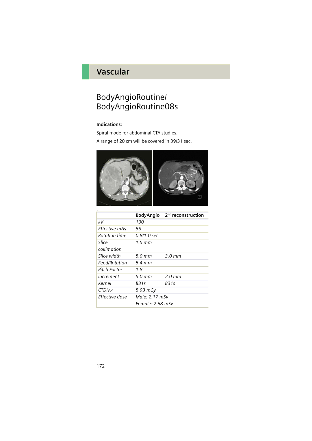 Siemens Software version syngo CT 2005C manual BodyAngioRoutine BodyAngioRoutine08s, BodyAngio 2nd reconstruction 