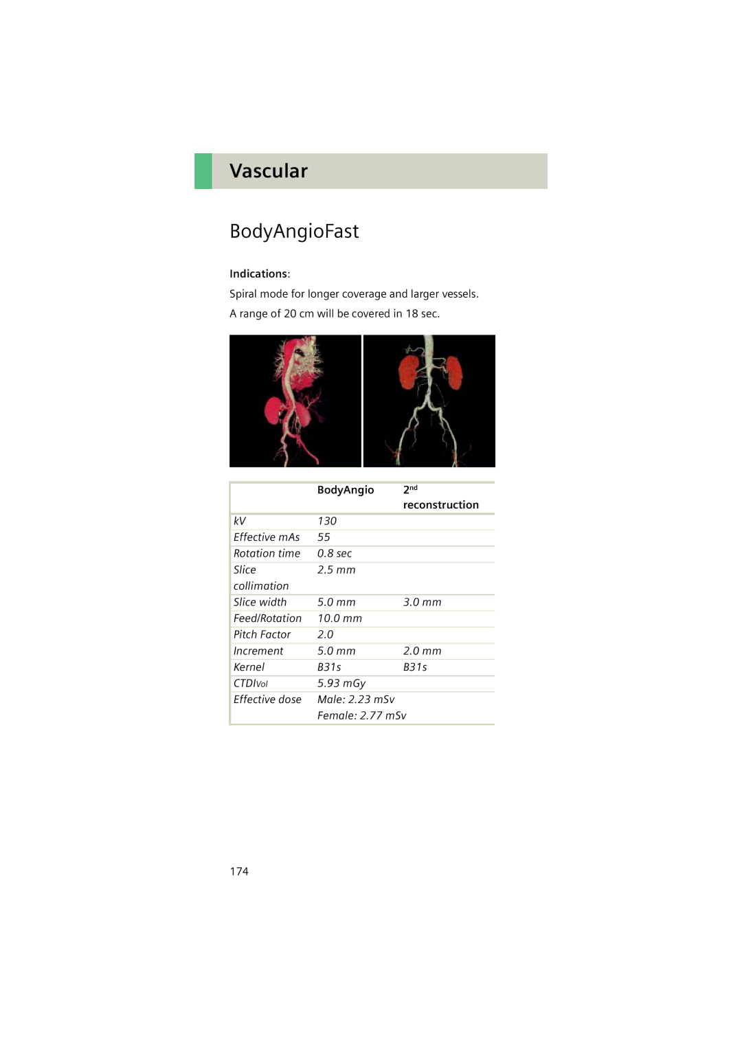 Siemens Software version syngo CT 2005C manual BodyAngioFast 