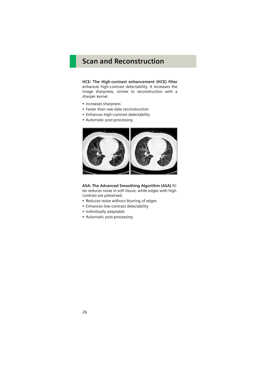 Siemens Software version syngo CT 2005C manual Scan and Reconstruction 