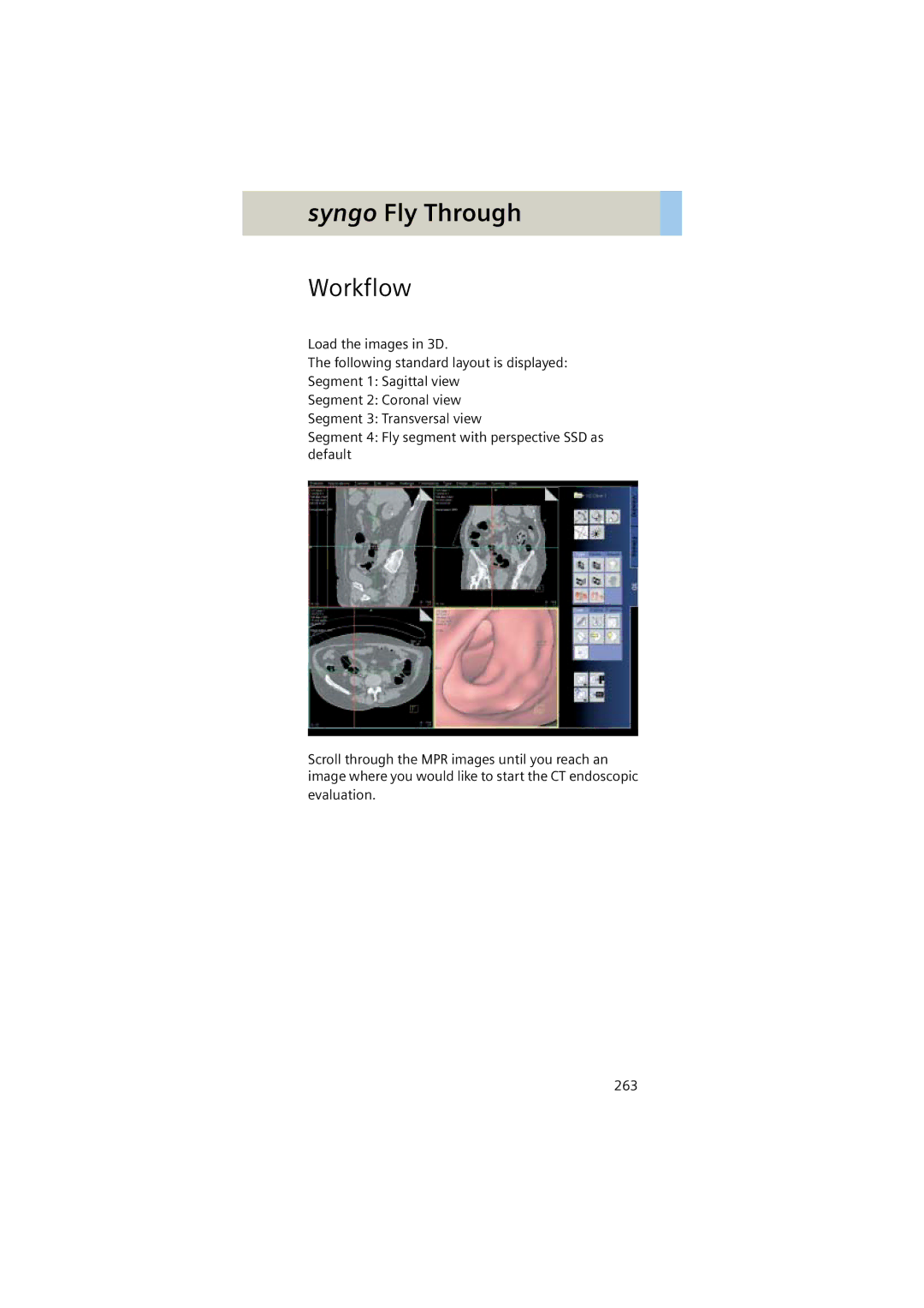 Siemens Software version syngo CT 2005C manual Workflow 