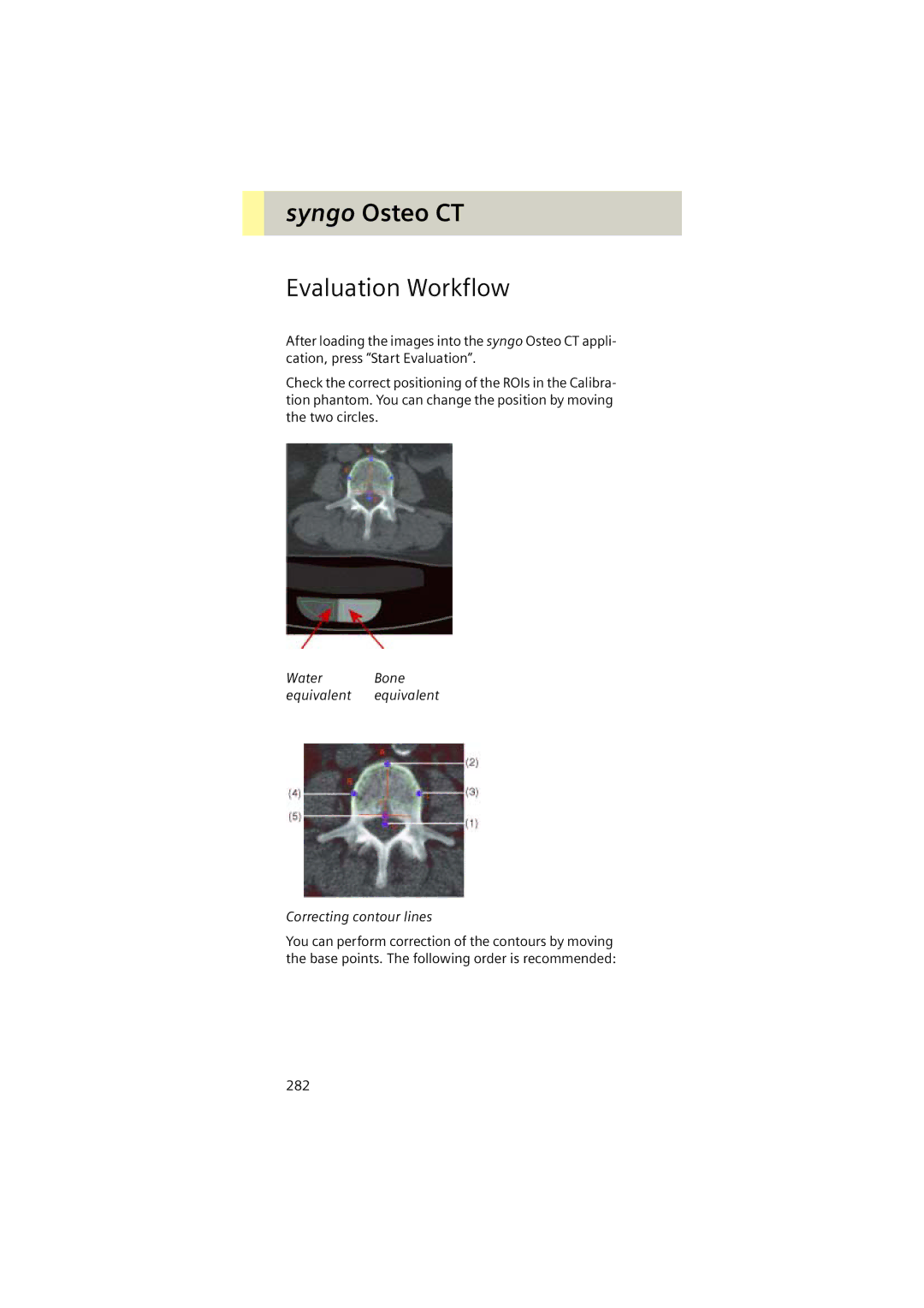 Siemens Software version syngo CT 2005C Evaluation Workflow, Water Bone equivalent equivalent Correcting contour lines 