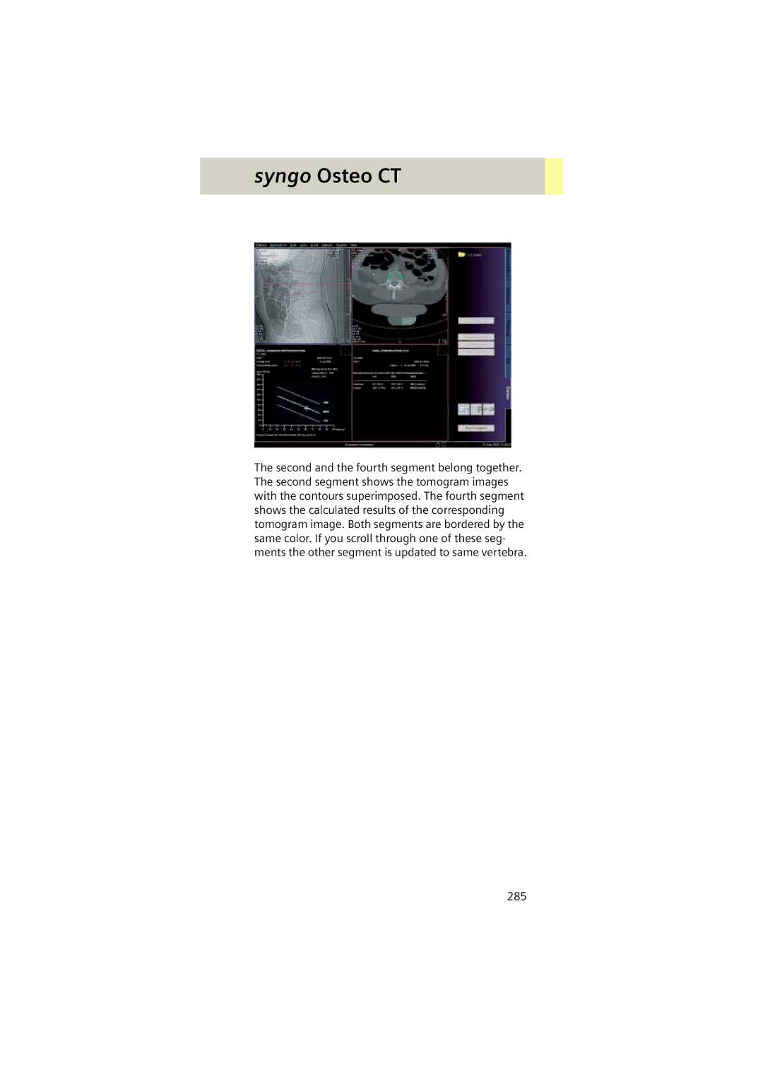 Siemens Software version syngo CT 2005C manual 285 