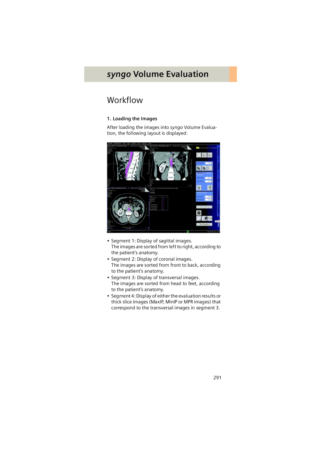 Siemens Software version syngo CT 2005C manual Workflow 