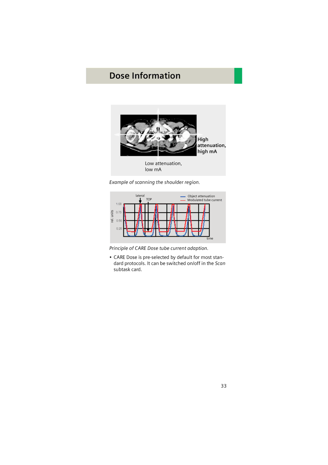 Siemens Software version syngo CT 2005C manual High attenuation, high mA, Example of scanning the shoulder region 