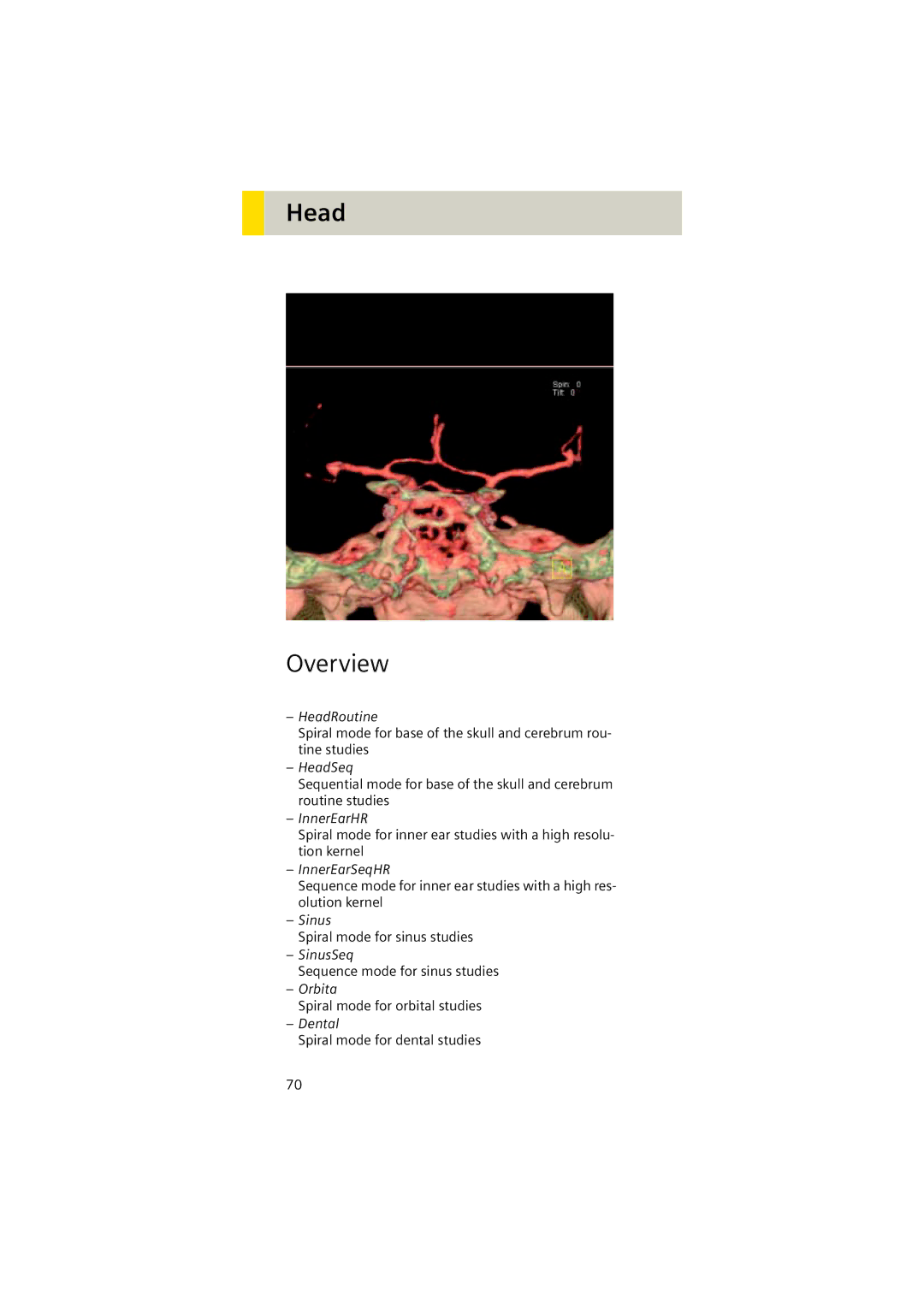 Siemens Software version syngo CT 2005C manual Head, Overview 