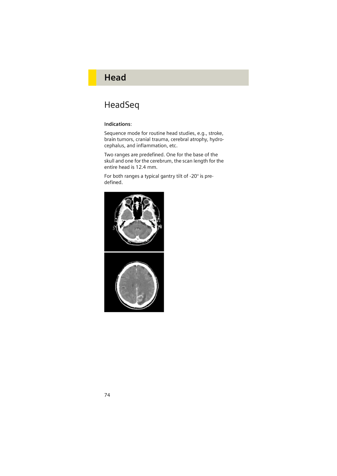 Siemens Software version syngo CT 2005C manual HeadSeq 