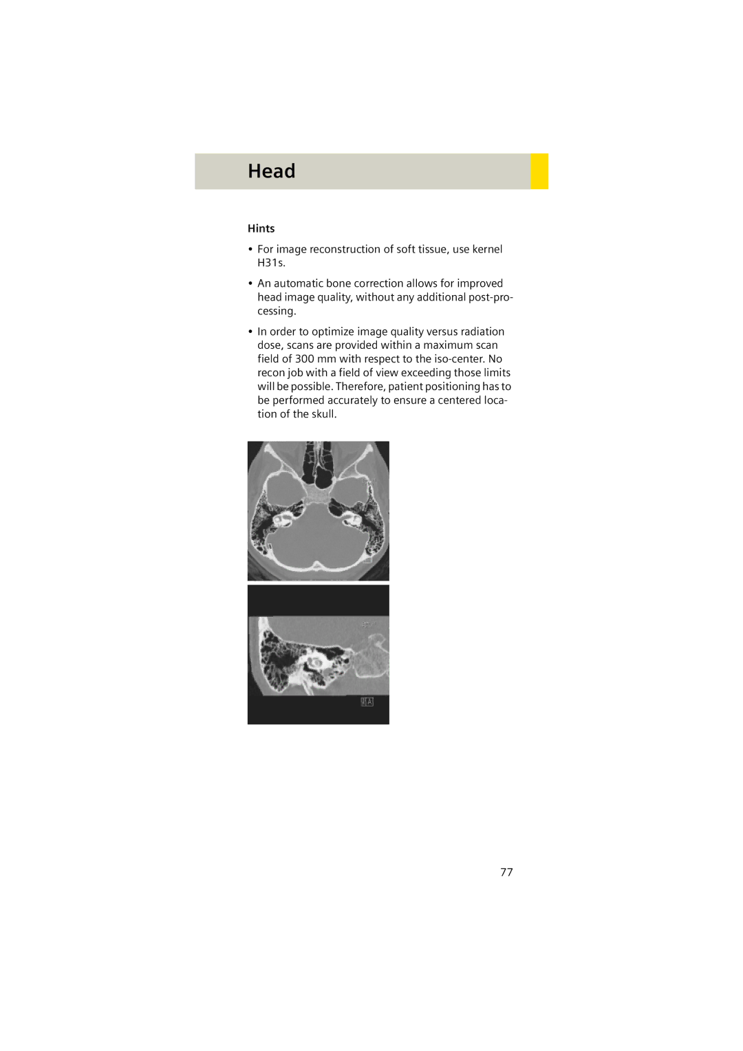 Siemens Software version syngo CT 2005C manual Head 