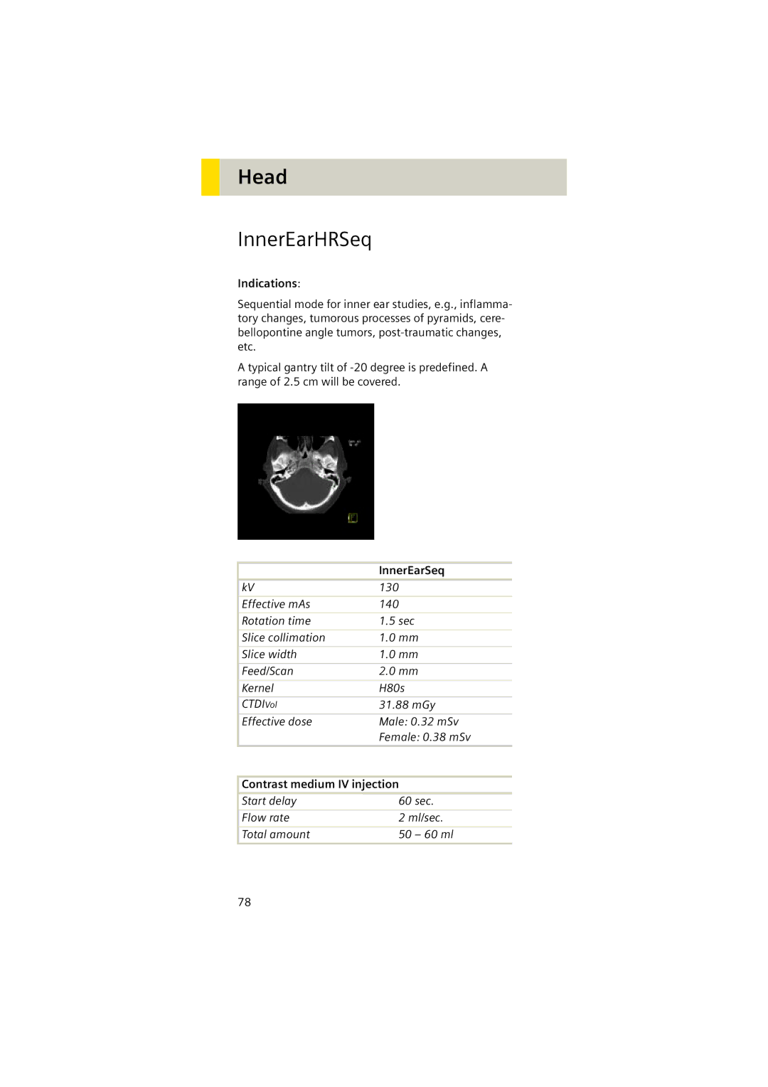 Siemens Software version syngo CT 2005C manual InnerEarHRSeq, InnerEarSeq, 130 