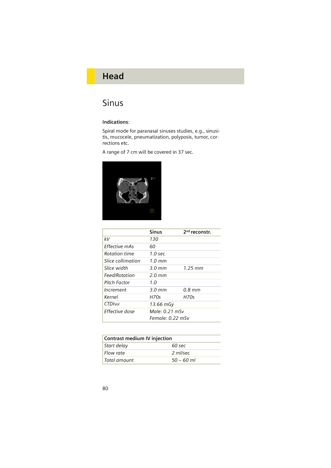 Siemens Software version syngo CT 2005C manual Sinus 2nd reconstr 