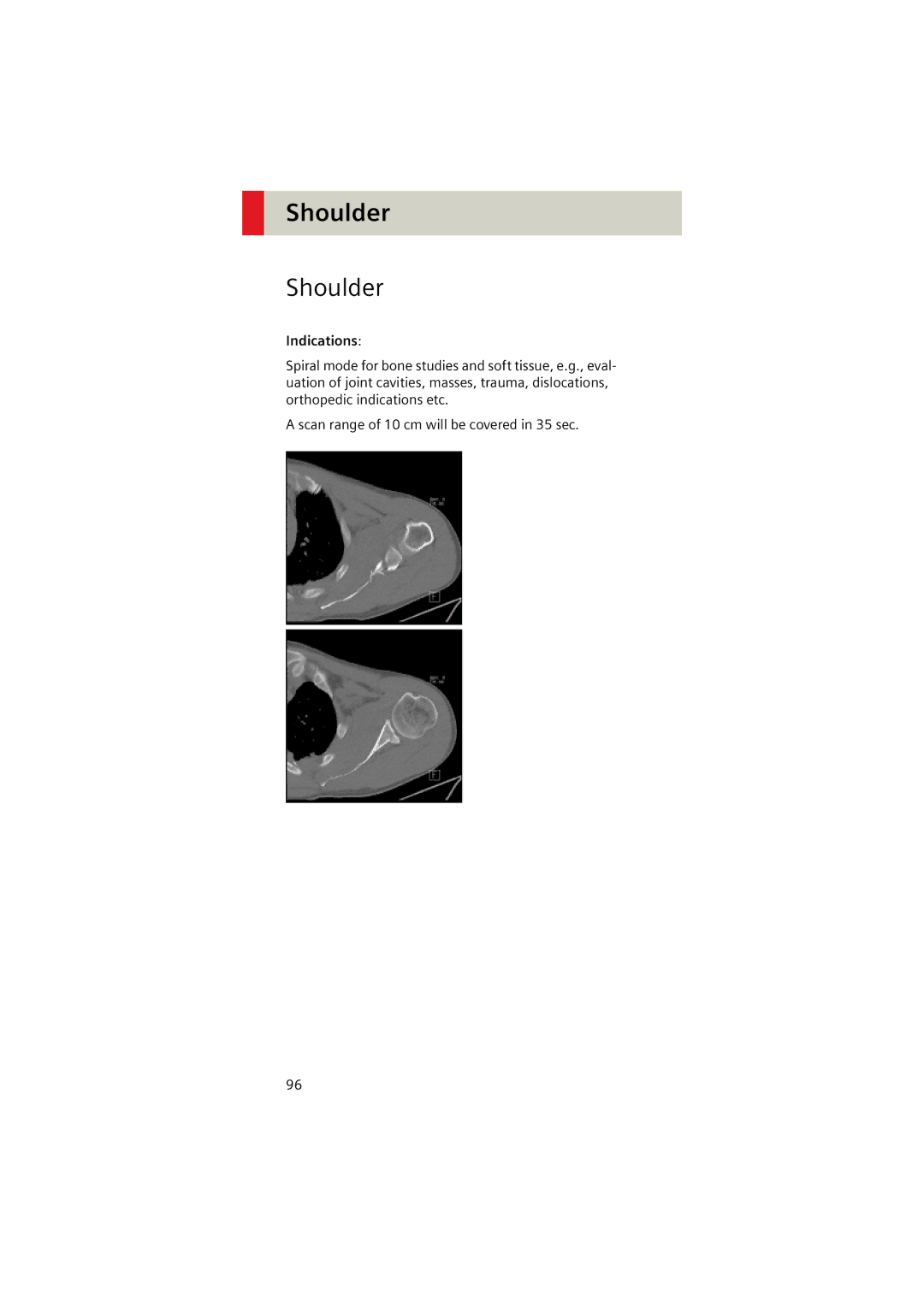 Siemens Software version syngo CT 2005C manual Shoulder, Indications 