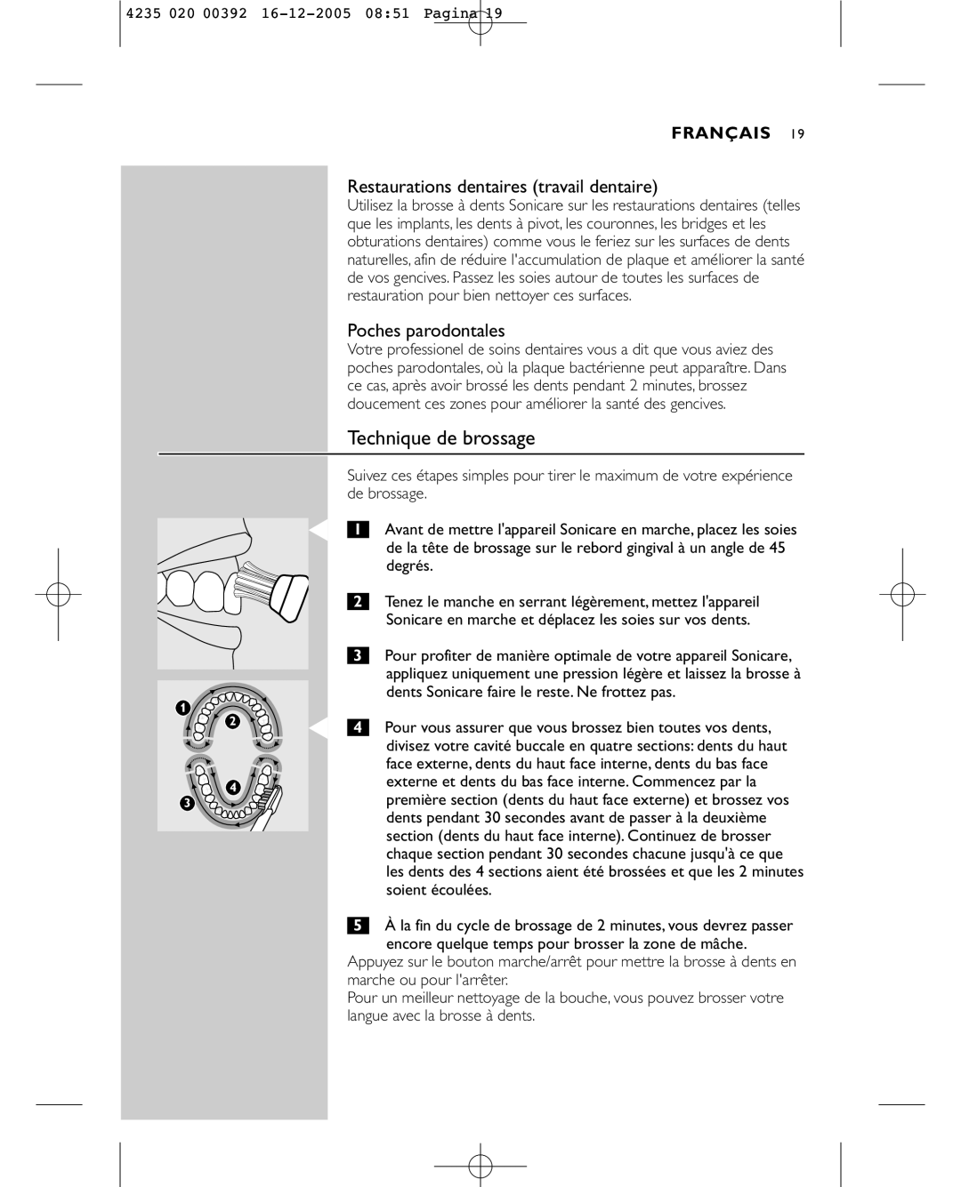 Sonicare HX4872 manual Technique de brossage, Restaurations dentaires travail dentaire, Poches parodontales 