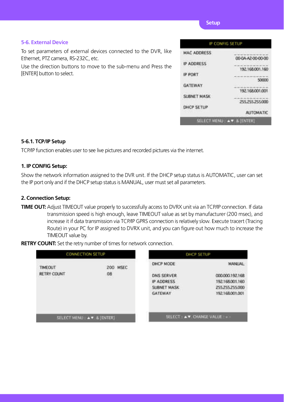 Stinger JPEG 2000 user manual External Device, TCP/IP Setup, IP Config Setup, Connection Setup 