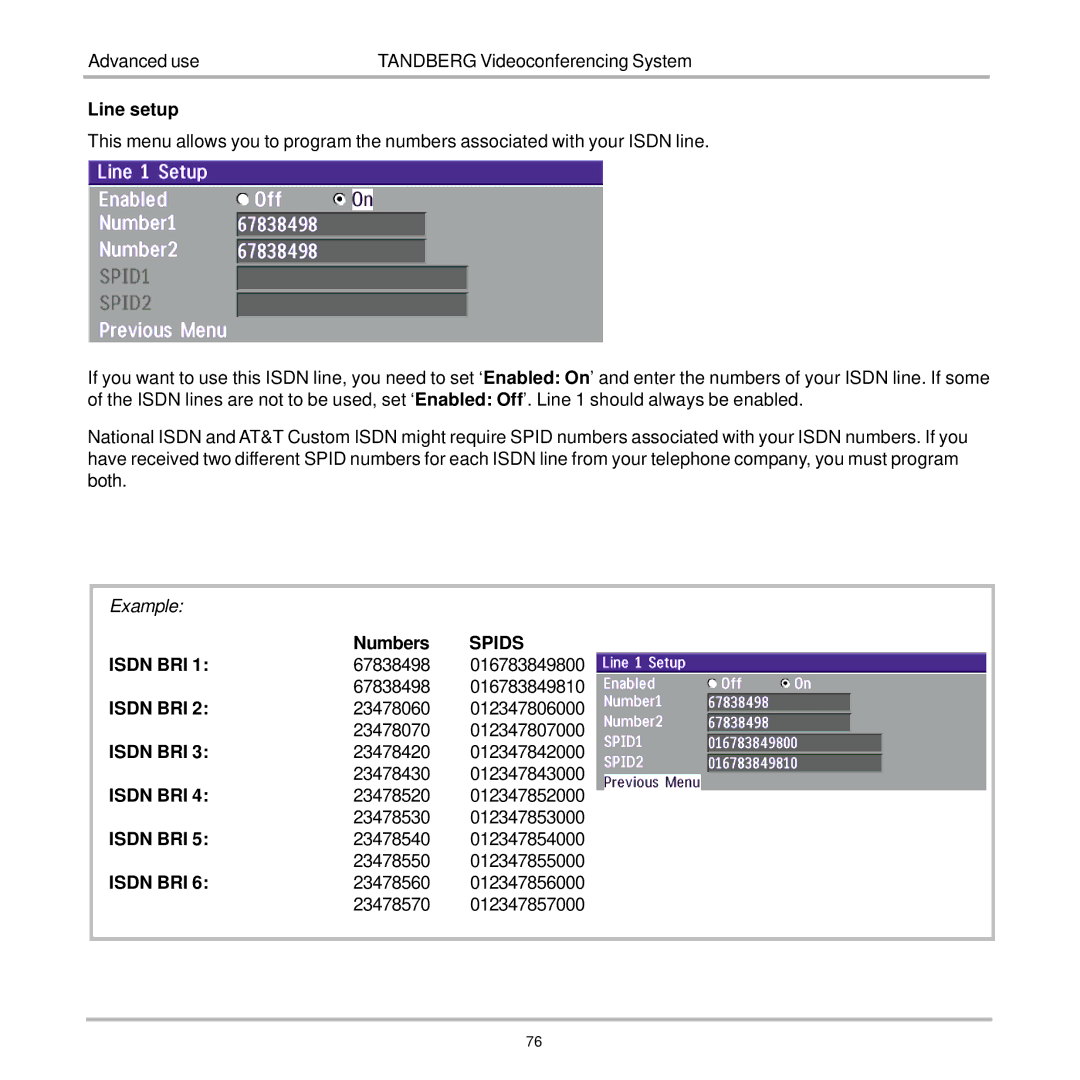 TANDBERG 7000 user manual Line setup 