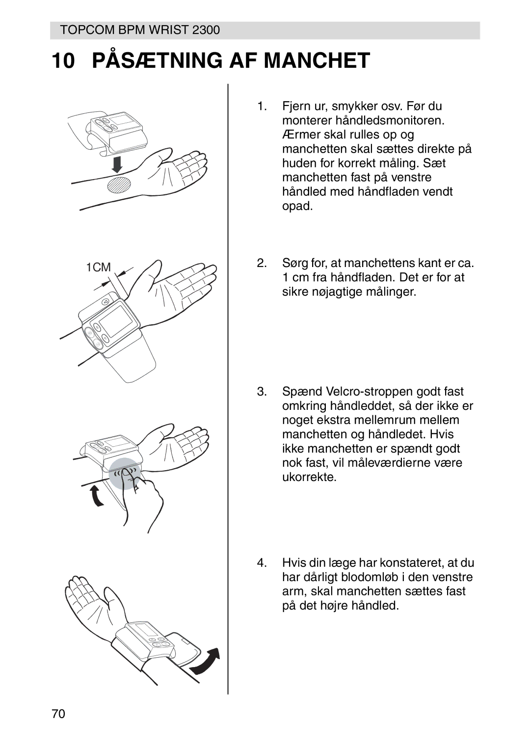 Topcom 2300 manual 10 Påsætning AF Manchet 