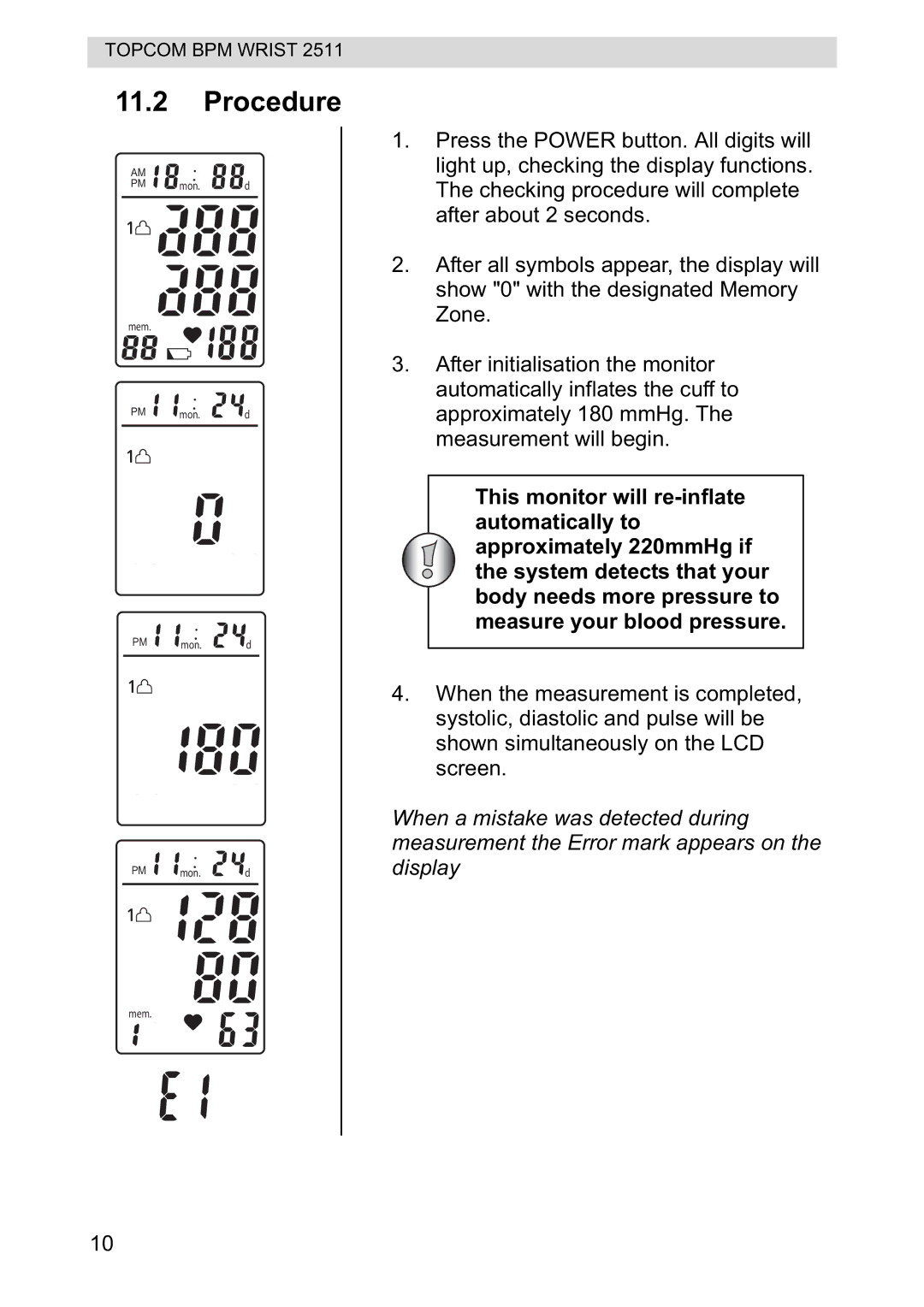 Topcom 2511 manual Procedure 