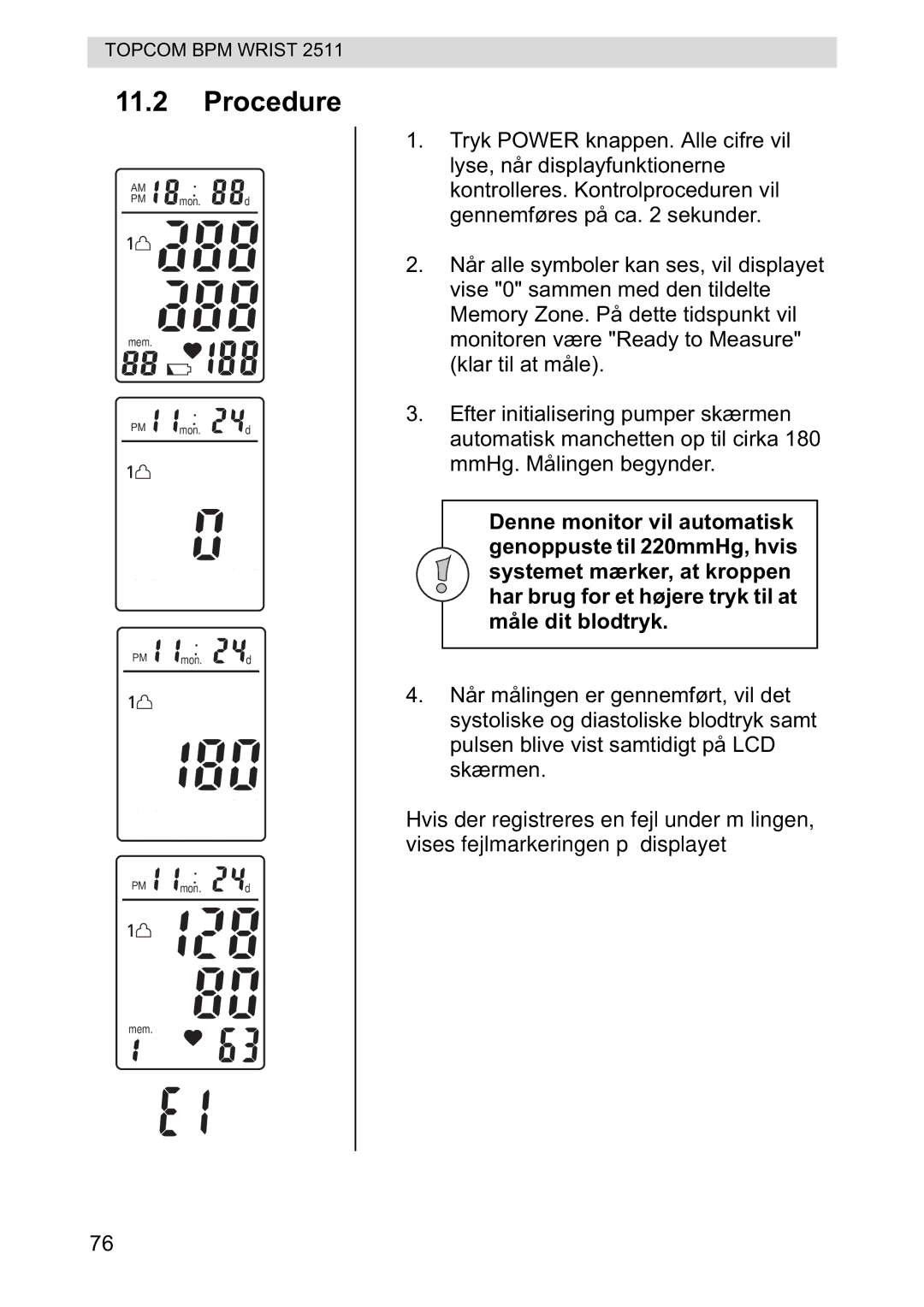 Topcom 2511 manual Procedure 