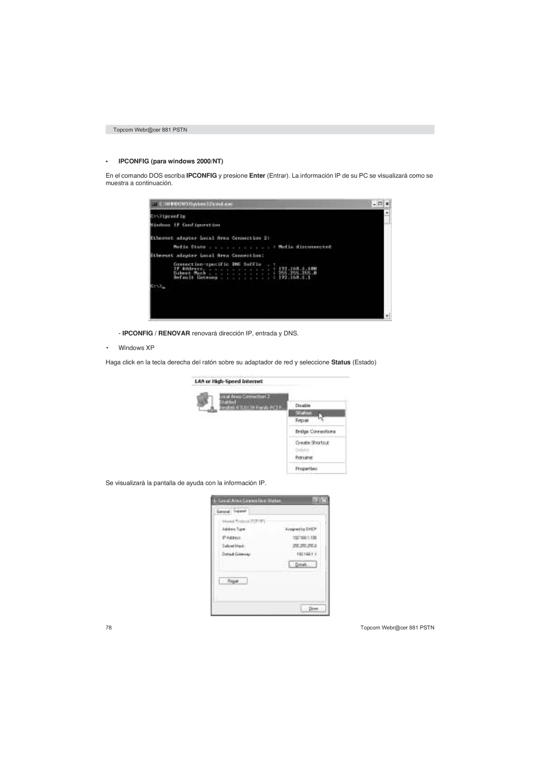 Topcom 881 PSTN manual do utilizador Ipconfig para windows 2000/NT 