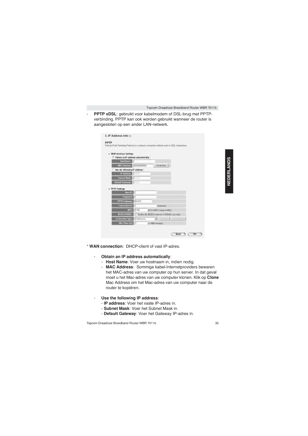 Topcom WBR 7011 B manual WAN connection DHCP-client of vast IP-adres, Obtain an IP address automatically 