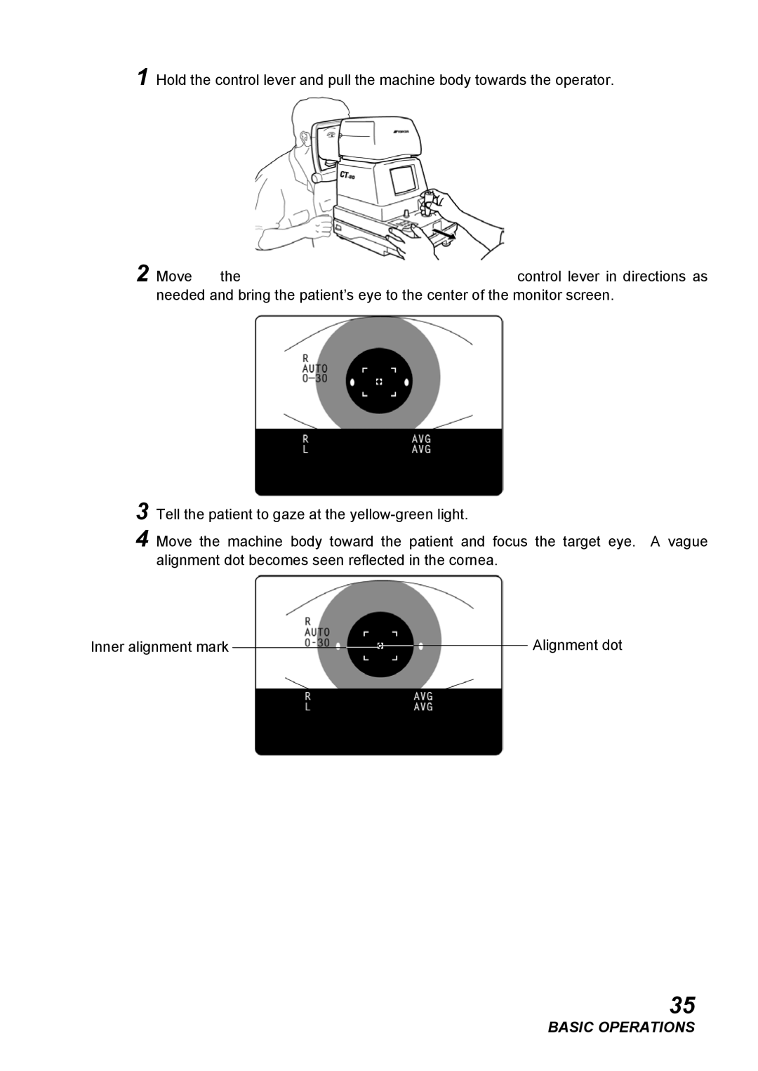 Topcon CT-80, COMPUTERIZED TONOMETER instruction manual Basic Operations 