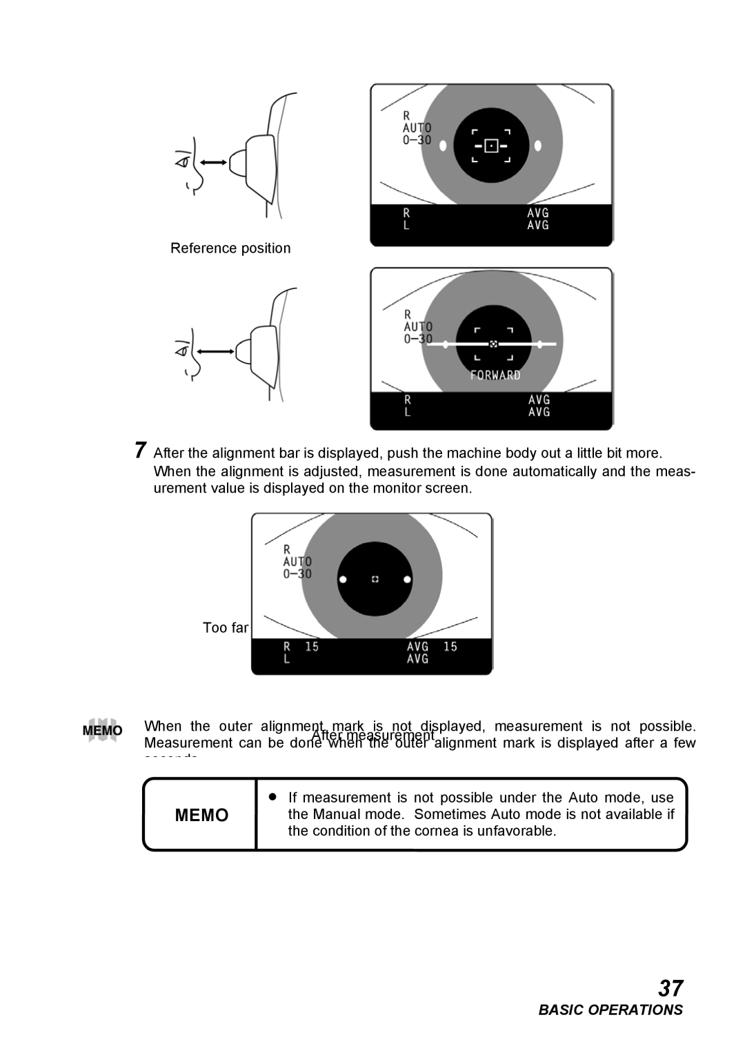 Topcon CT-80, COMPUTERIZED TONOMETER instruction manual Manual mode. Sometimes Auto mode is not available if 